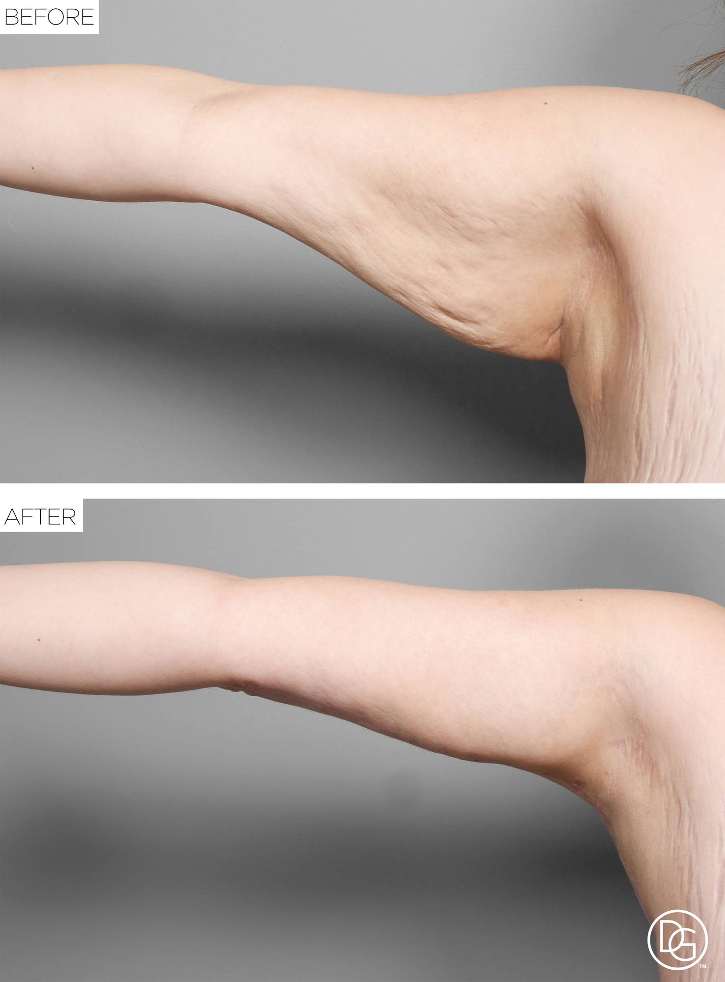 Before & After Image