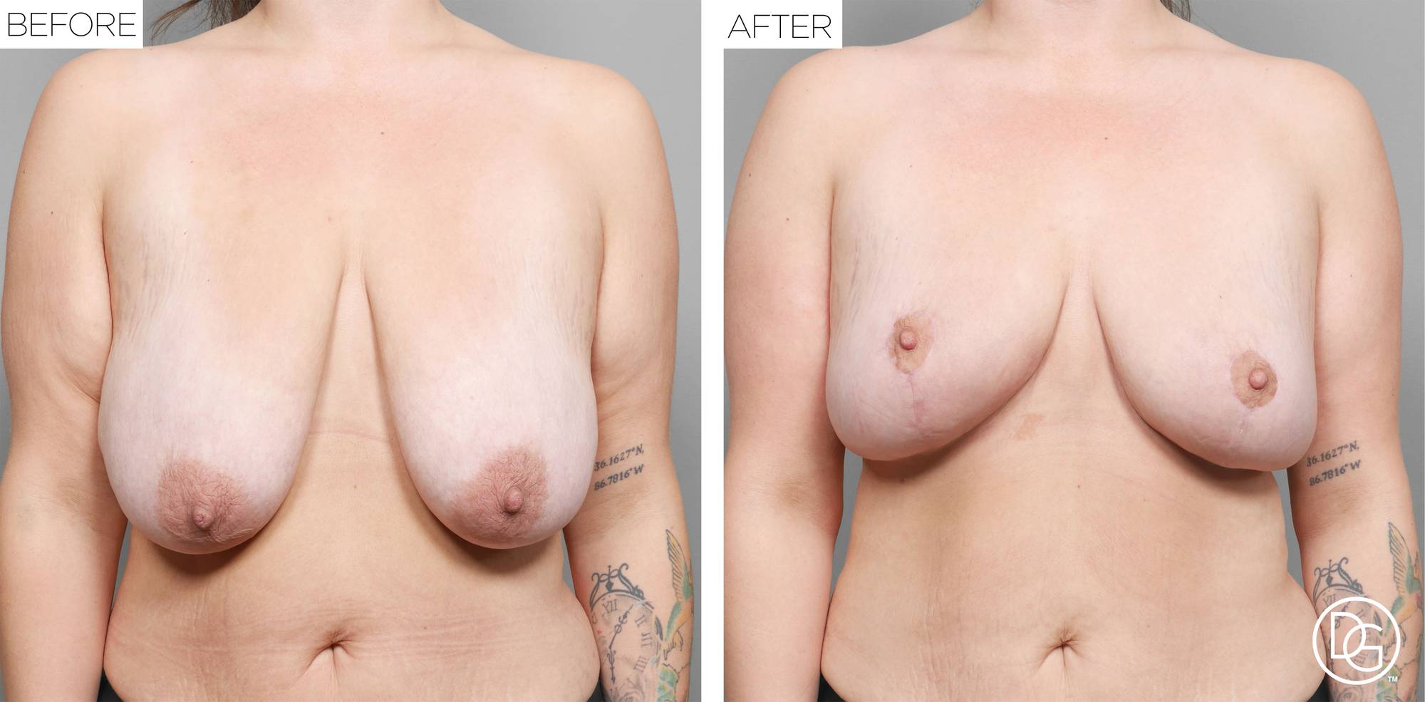 Before & After Image