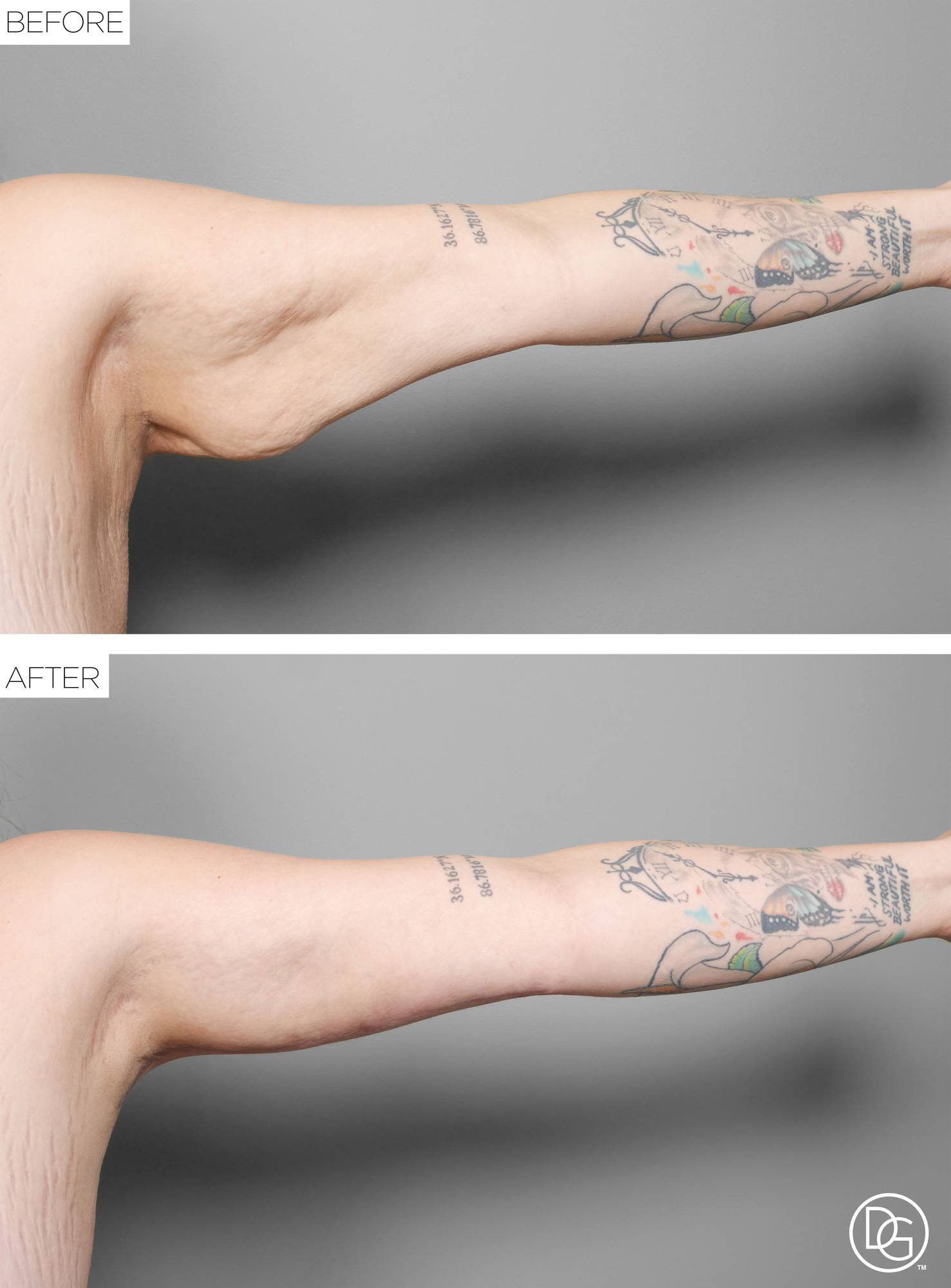 Before & After Image