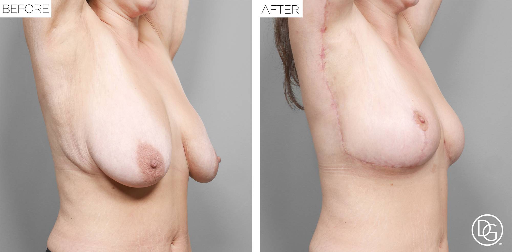 Before & After Image