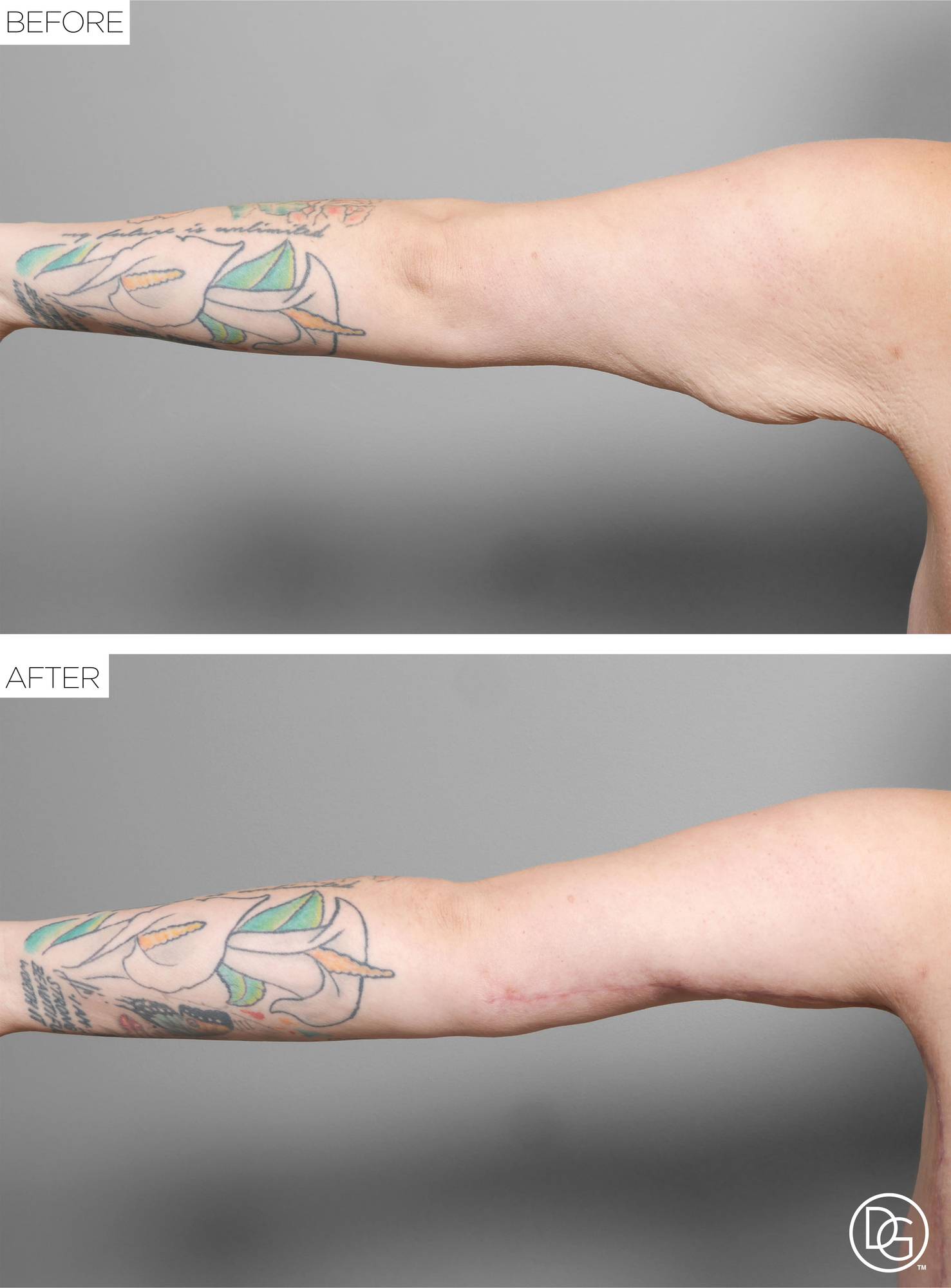 Before & After Image