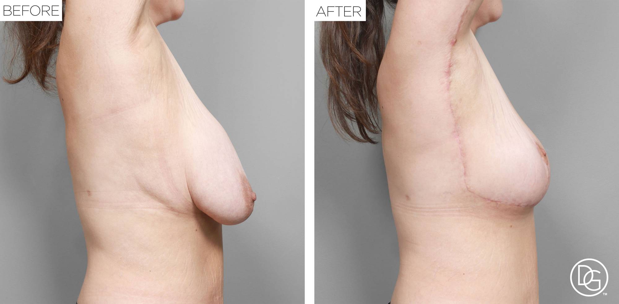 Before & After Image