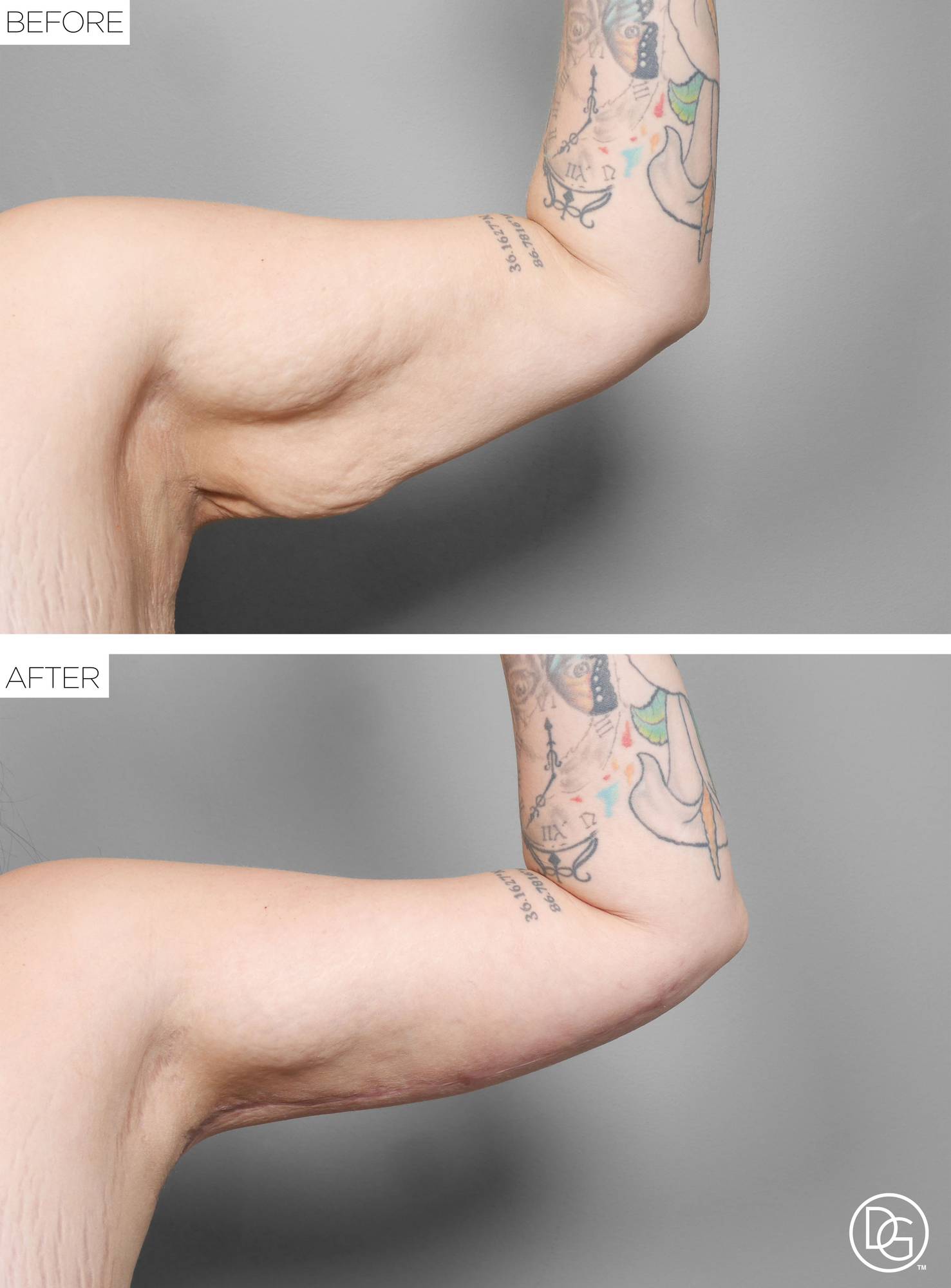 Before & After Image