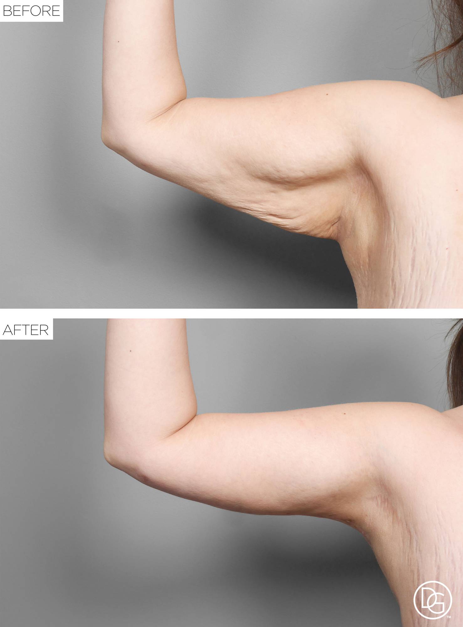 Before & After Image