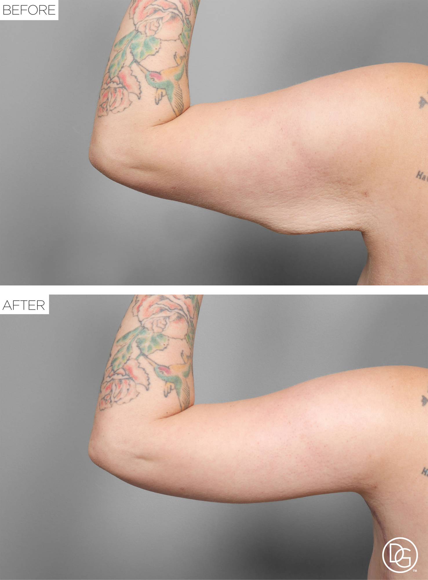 Before & After Image