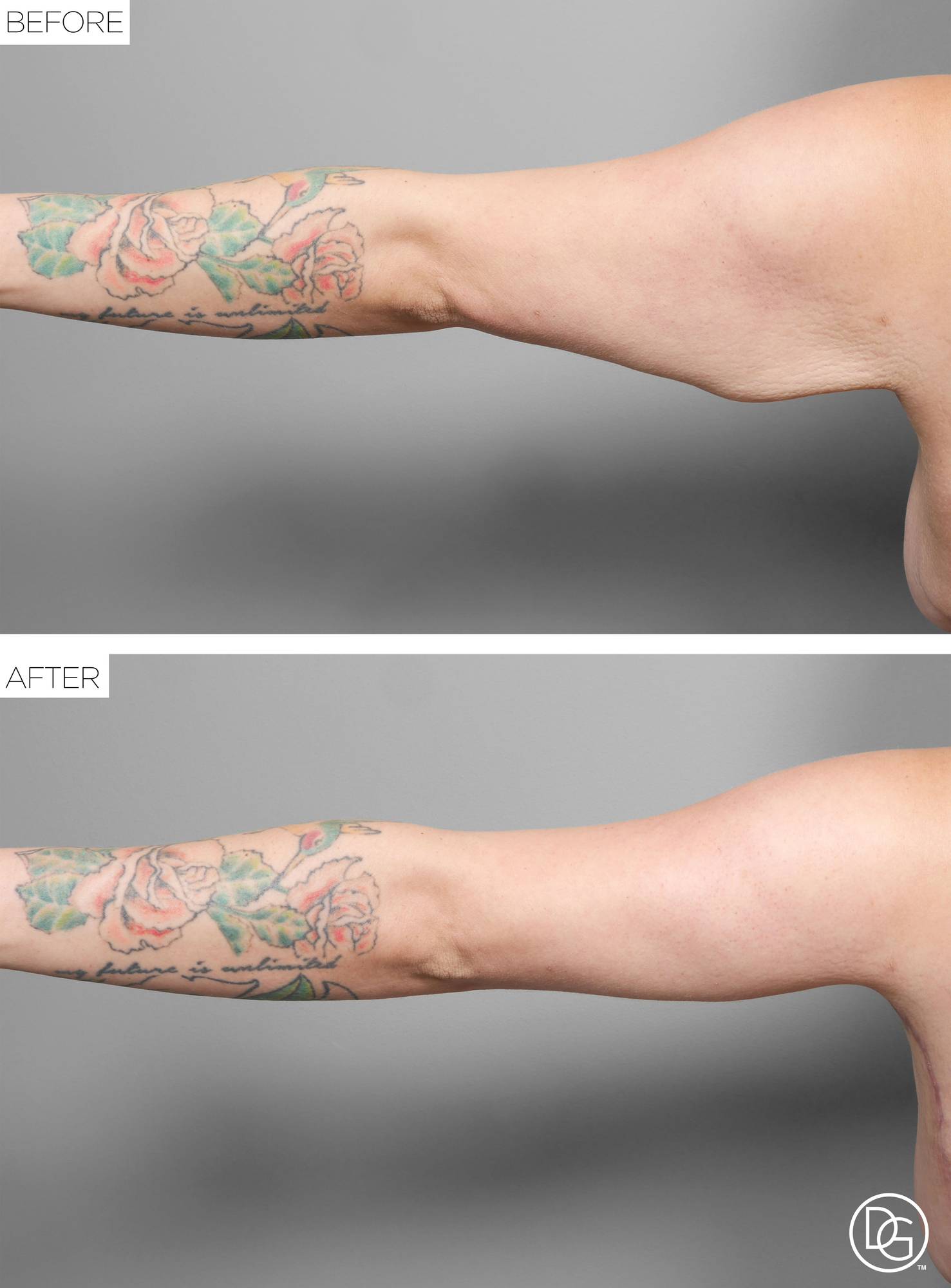 Before & After Image