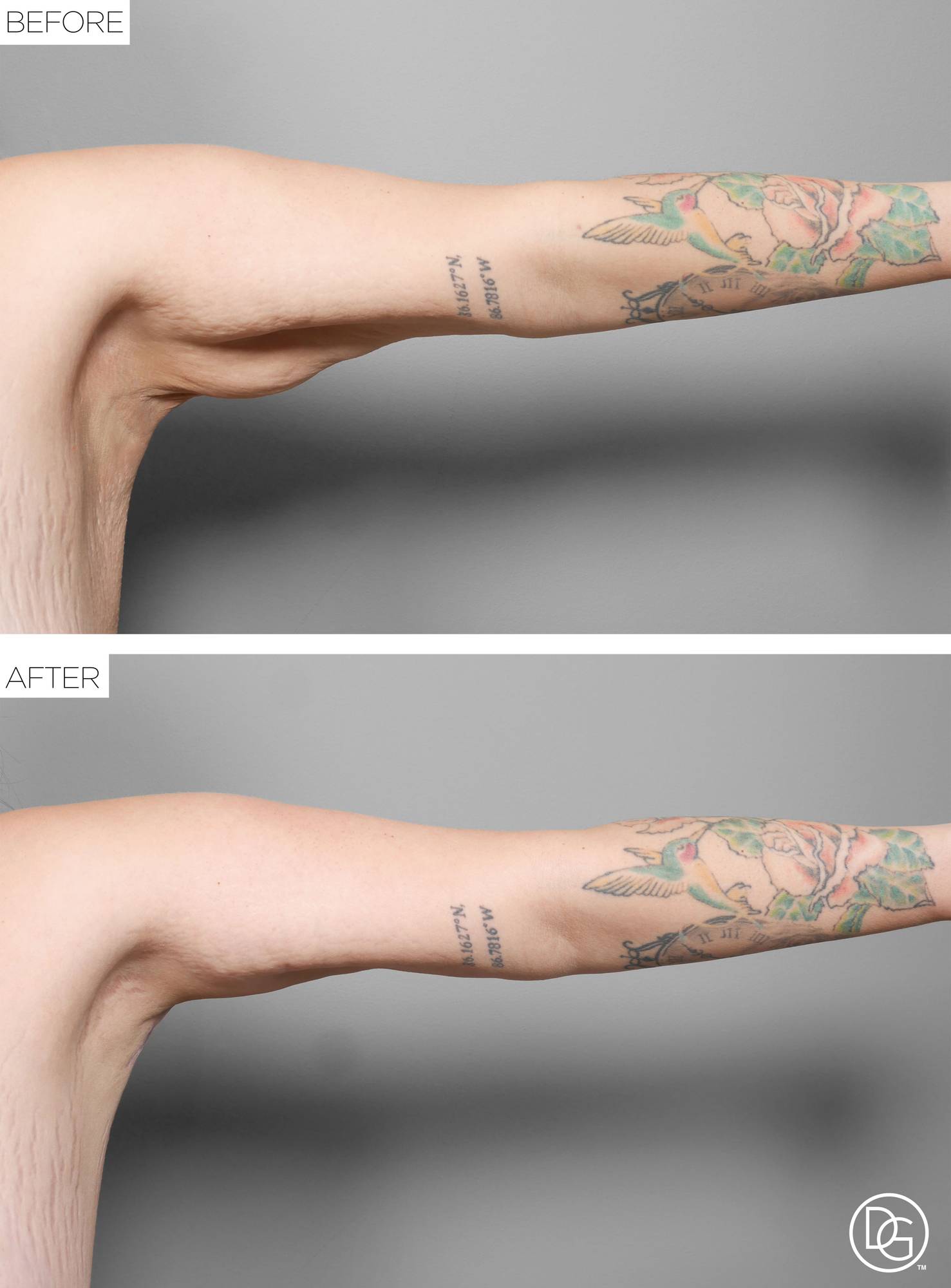 Before & After Image