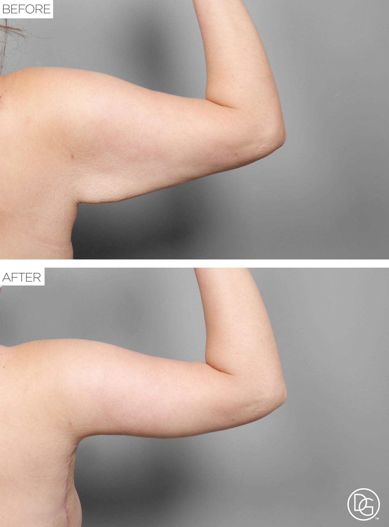 Before & After Image