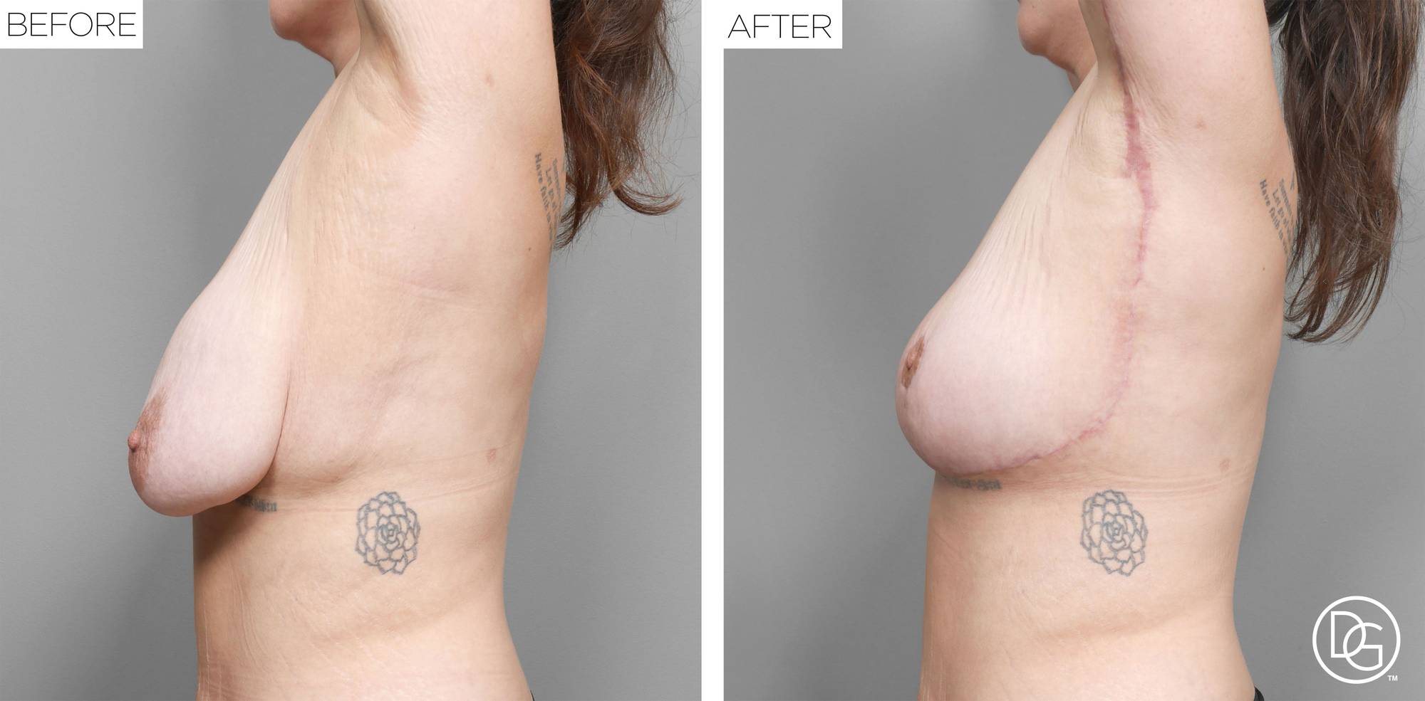 Before & After Image