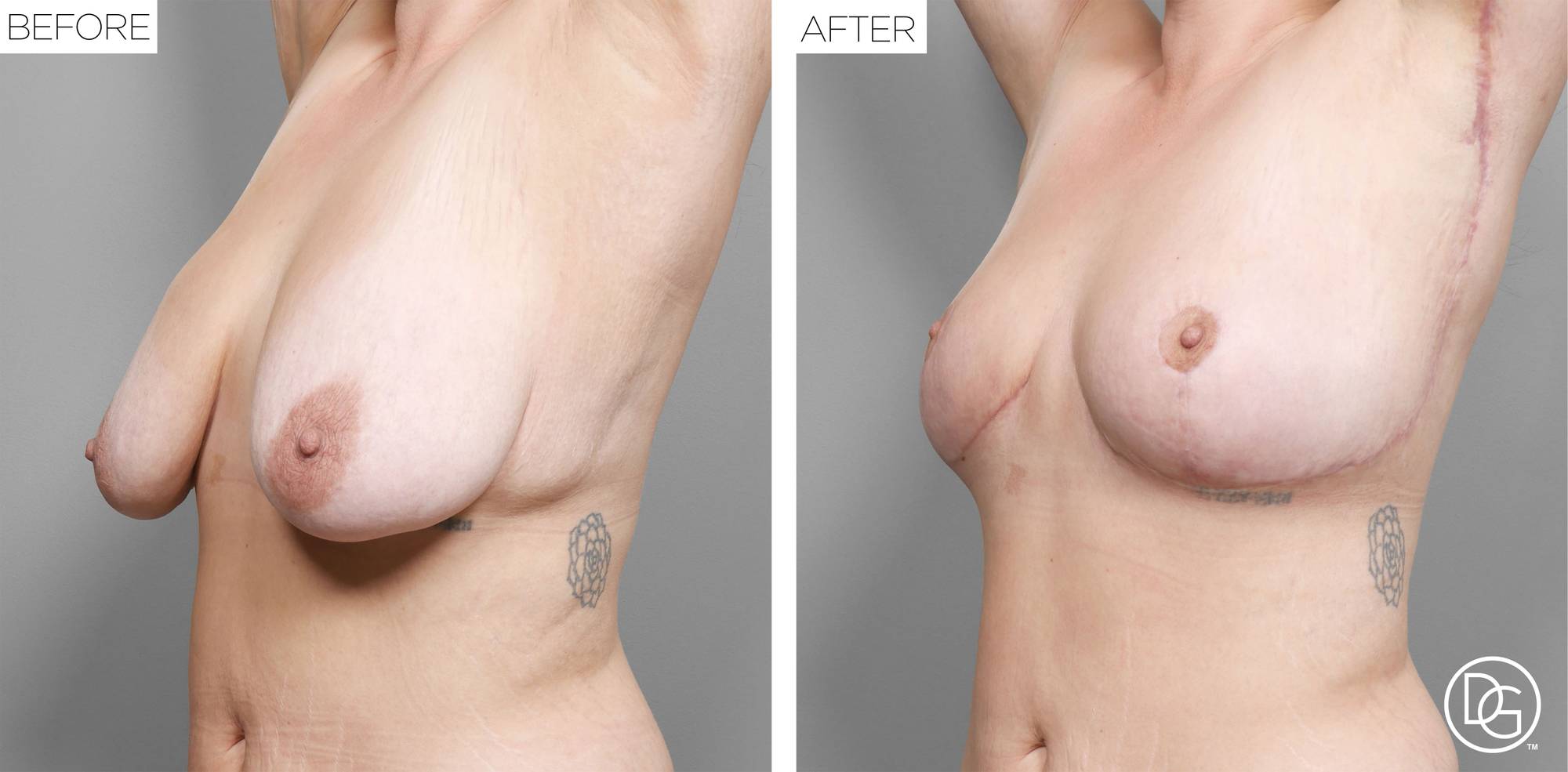 Before & After Image