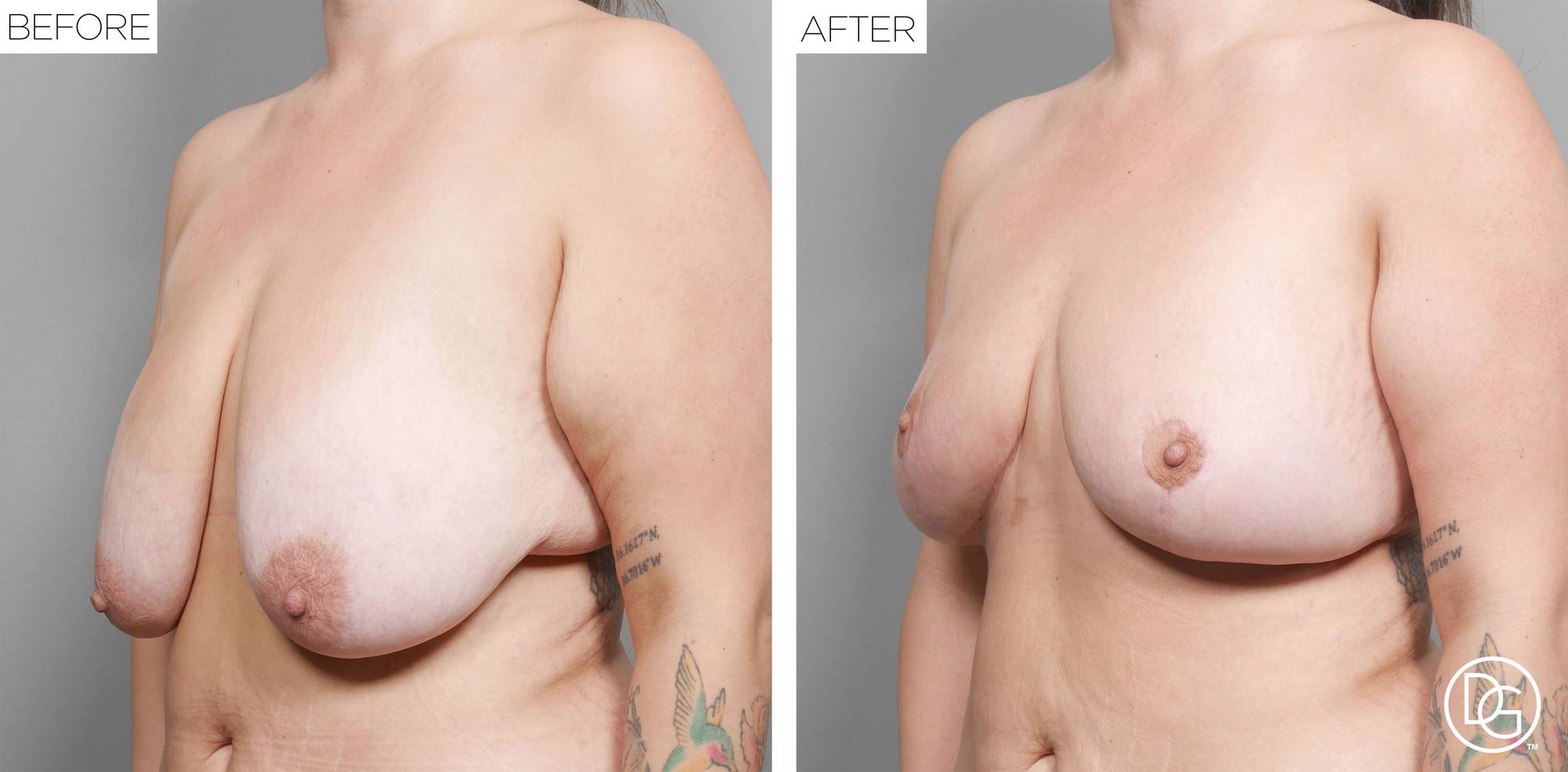 Before & After Image