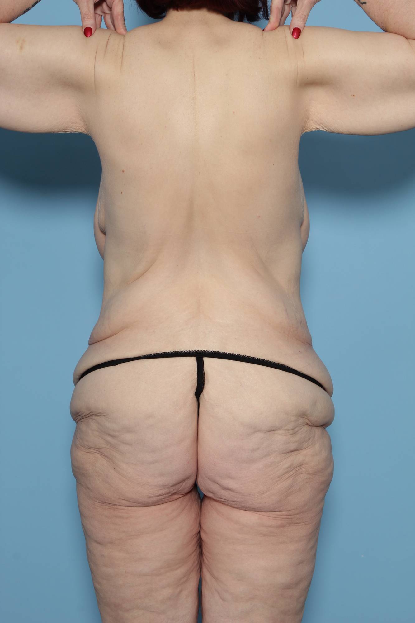 Before & After Image