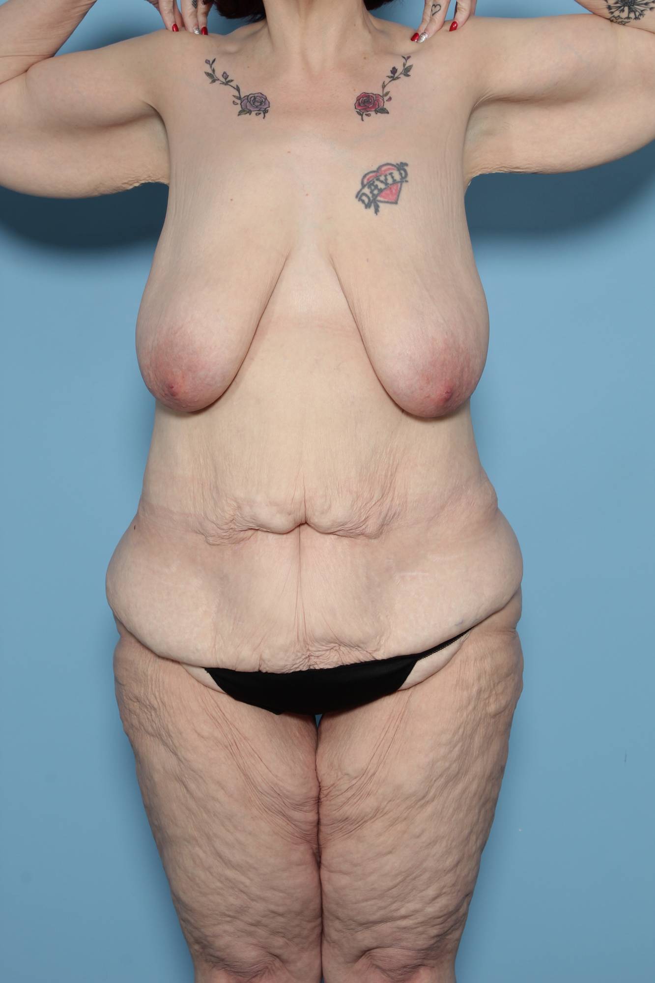 Before & After Image
