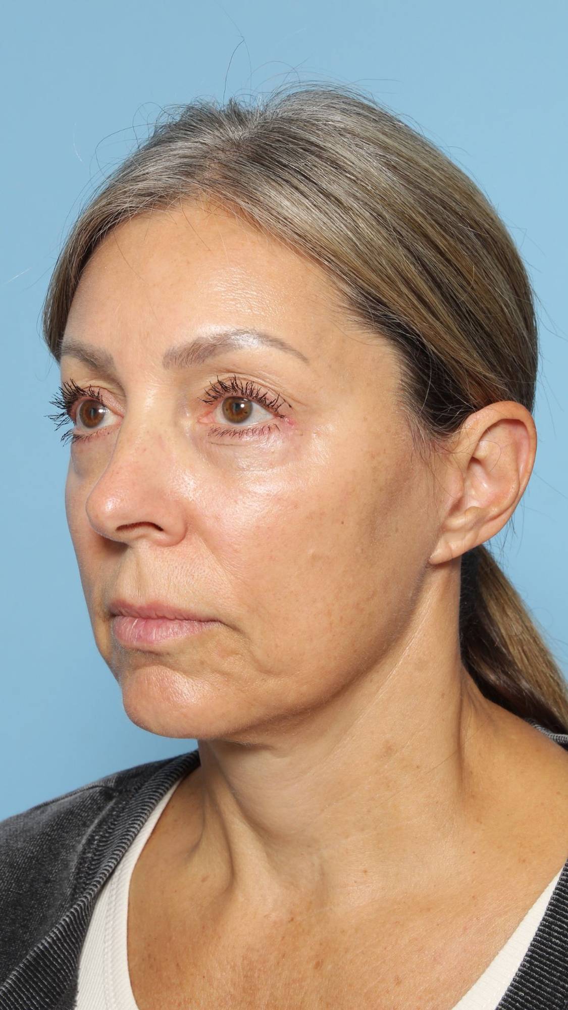 Before & After Image