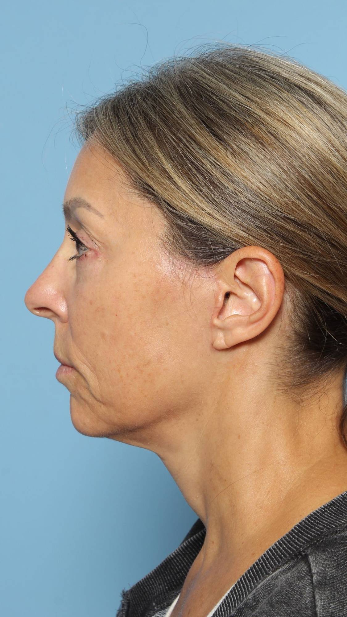 Before & After Image