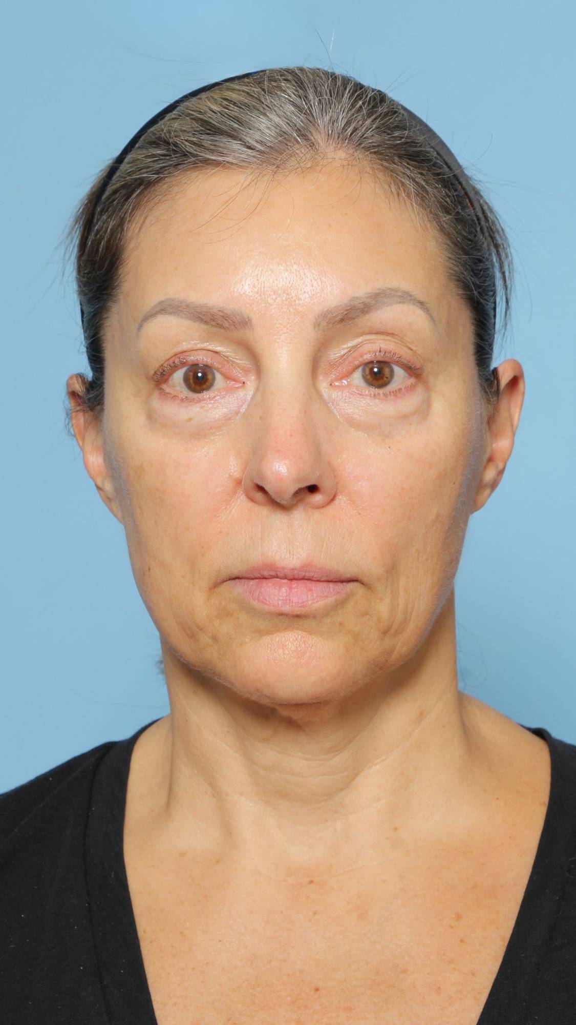 Before & After Image