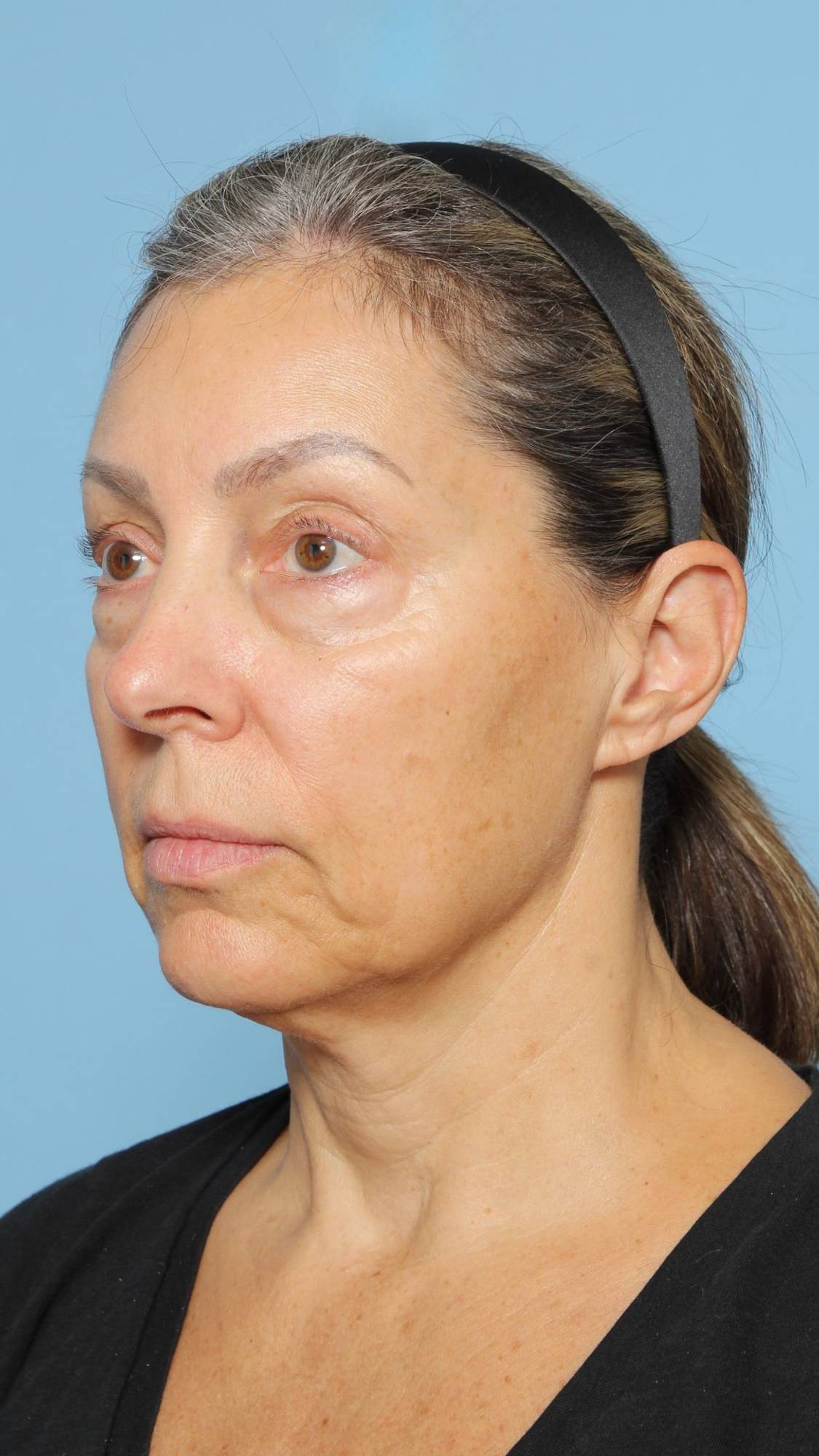 Before & After Image