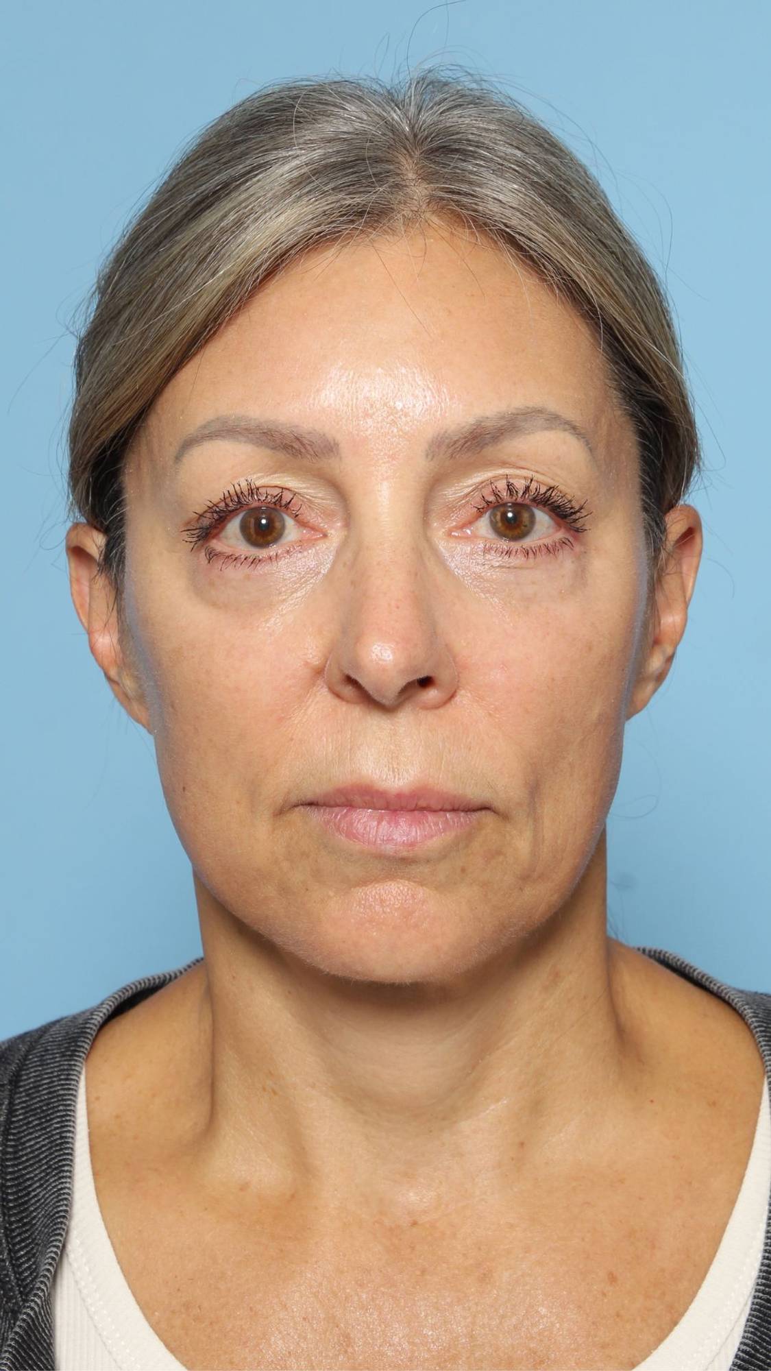 Before & After Image