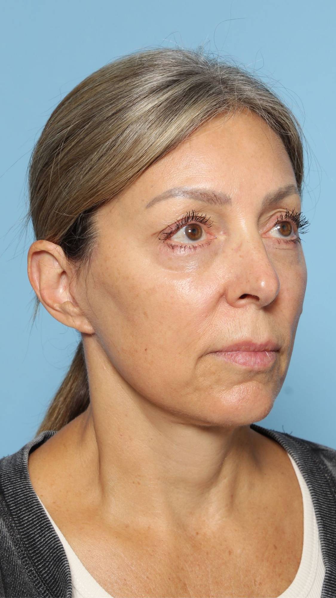 Before & After Image