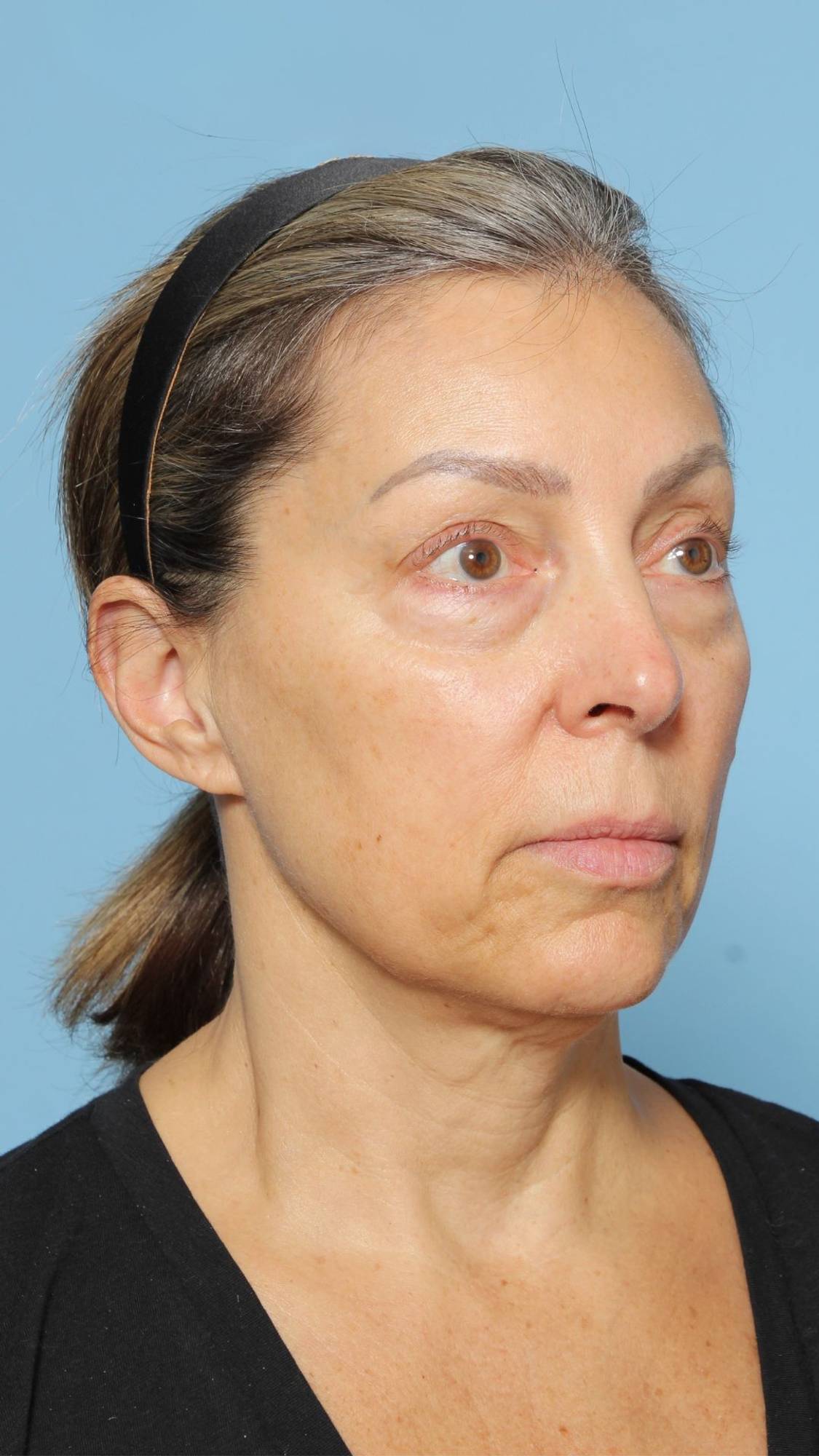 Before & After Image