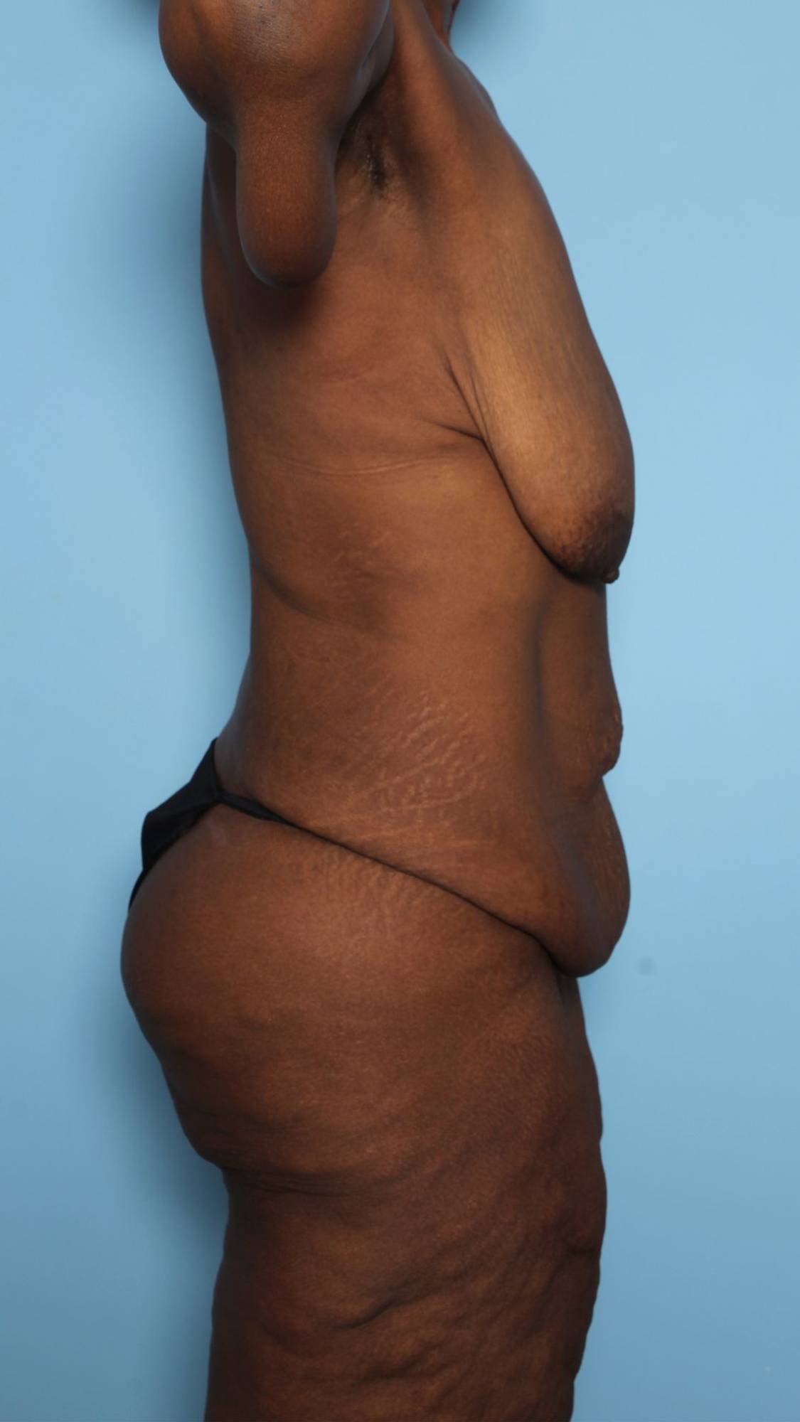 Before & After Image