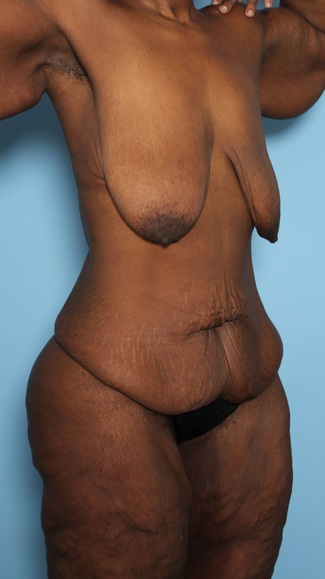 Before & After Image