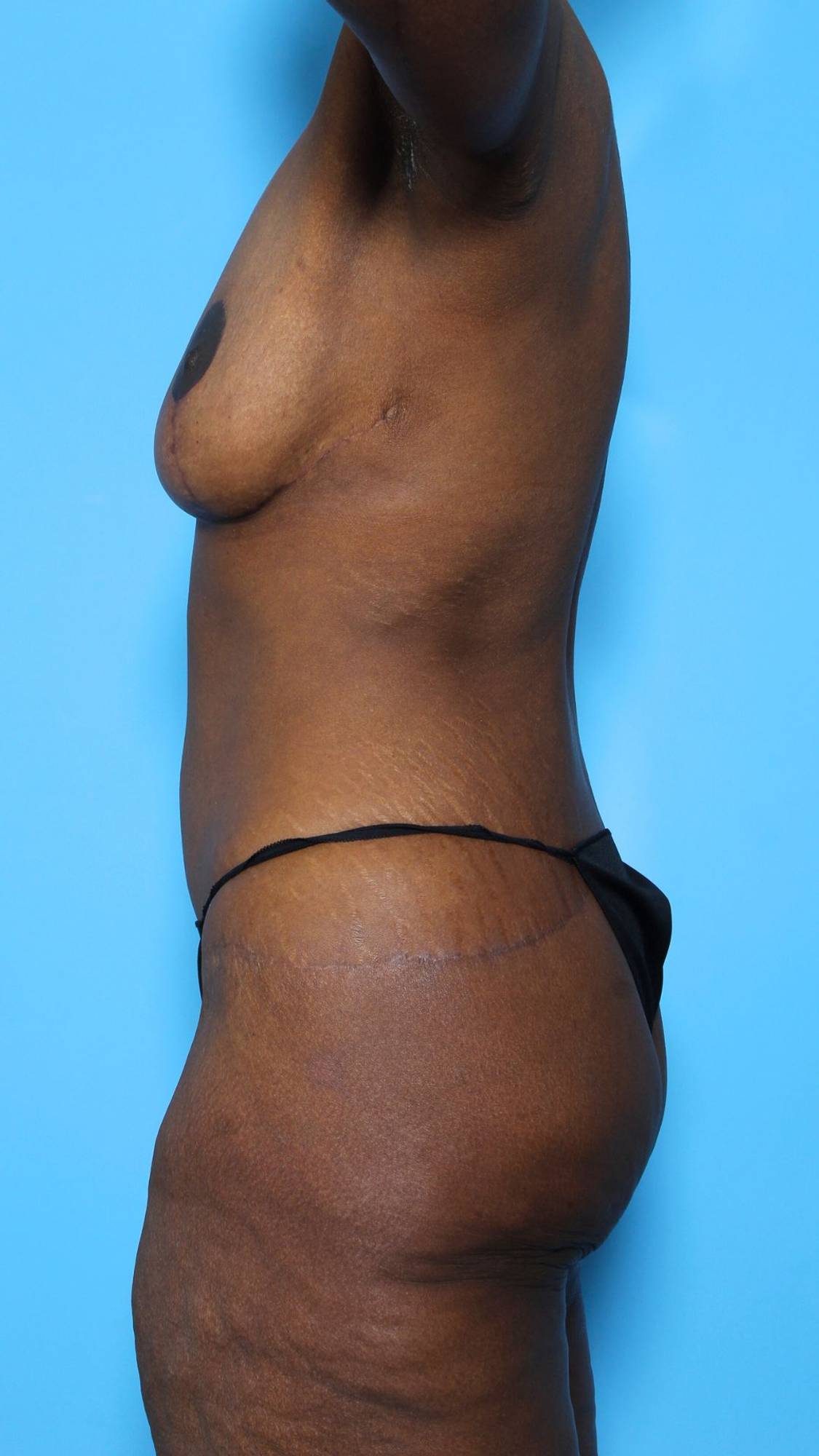 Before & After Image