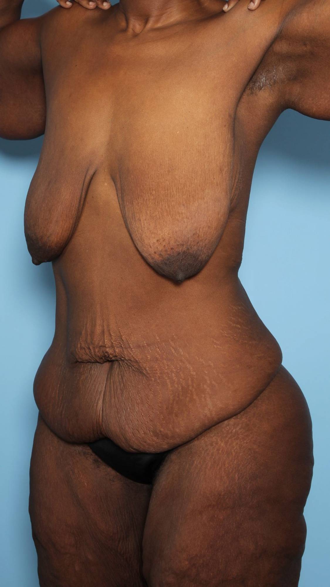 Before & After Image