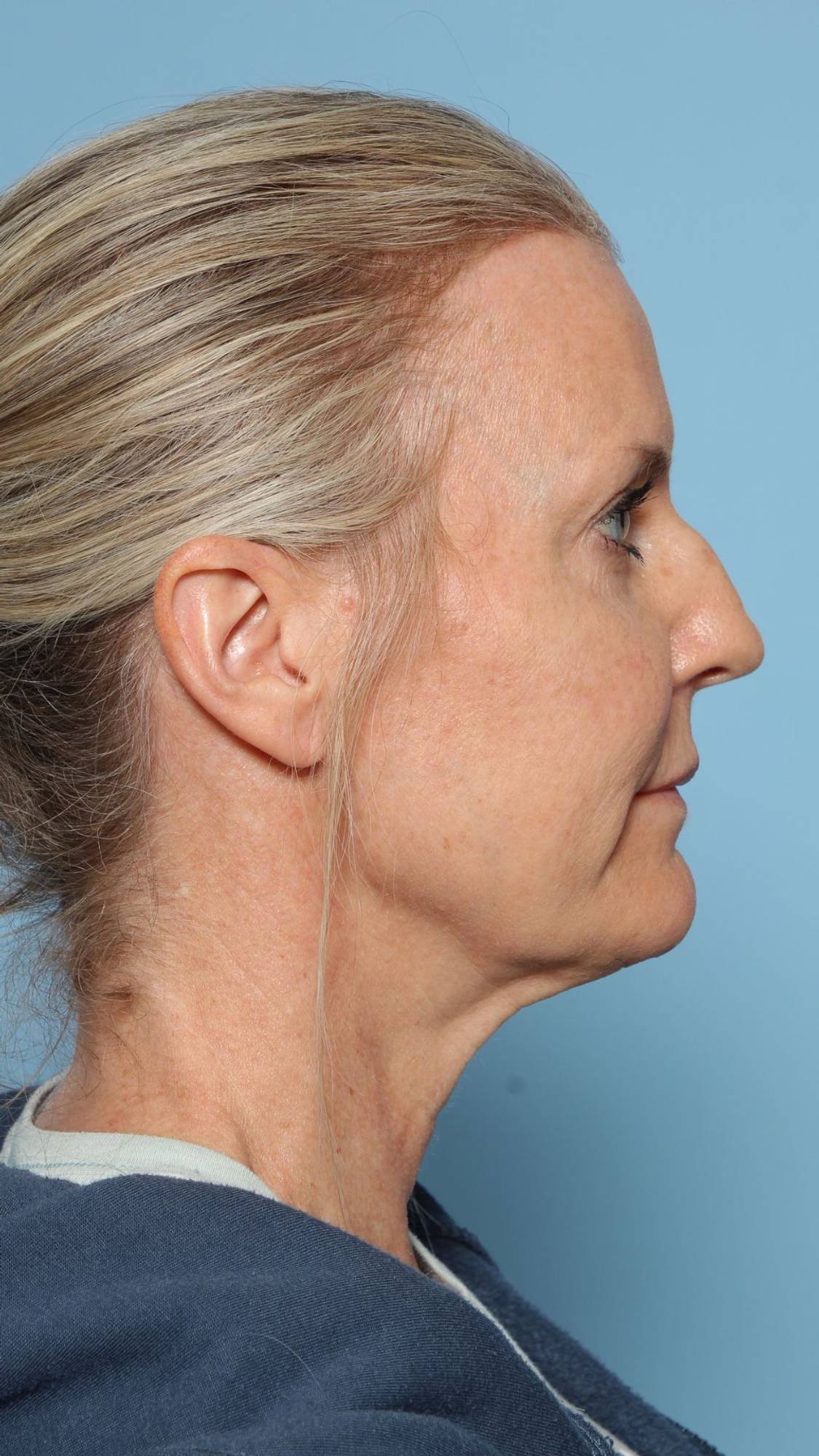 Before & After Image