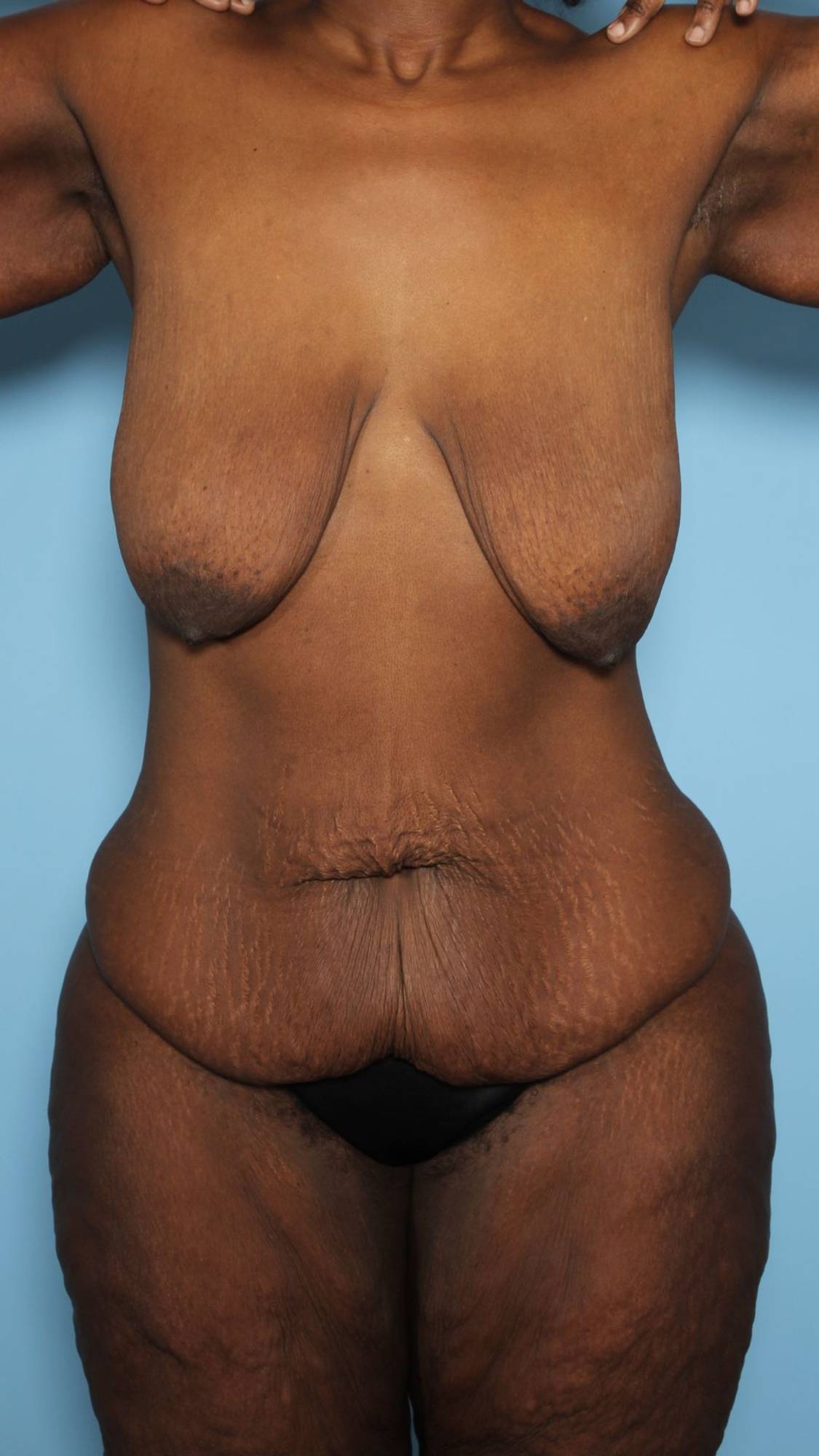 Before & After Image