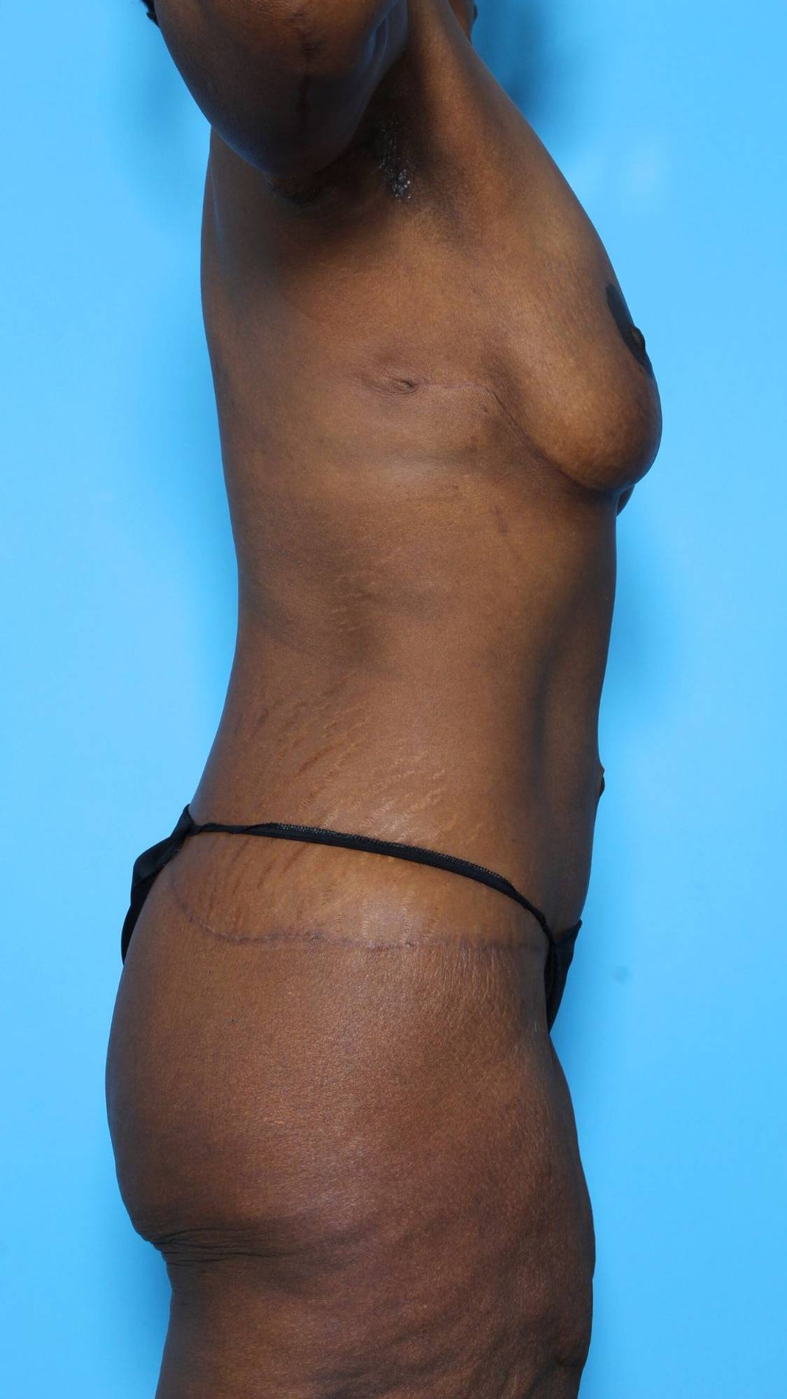 Before & After Image