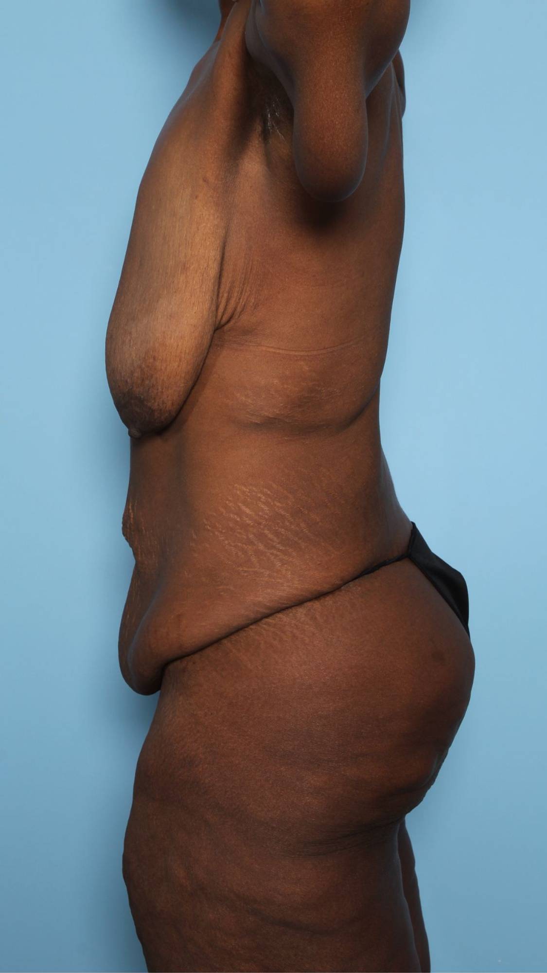 Before & After Image