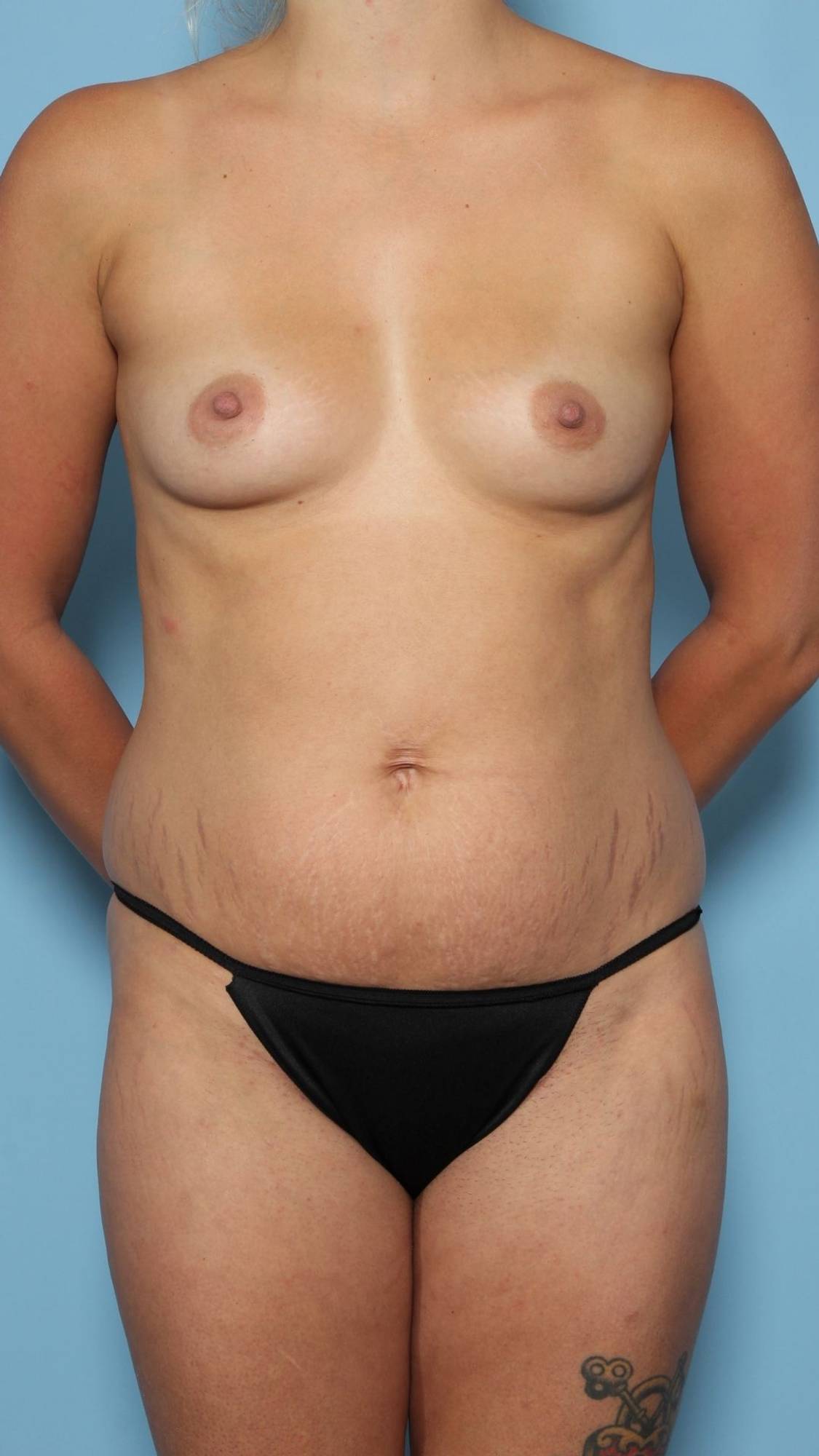 Before & After Image