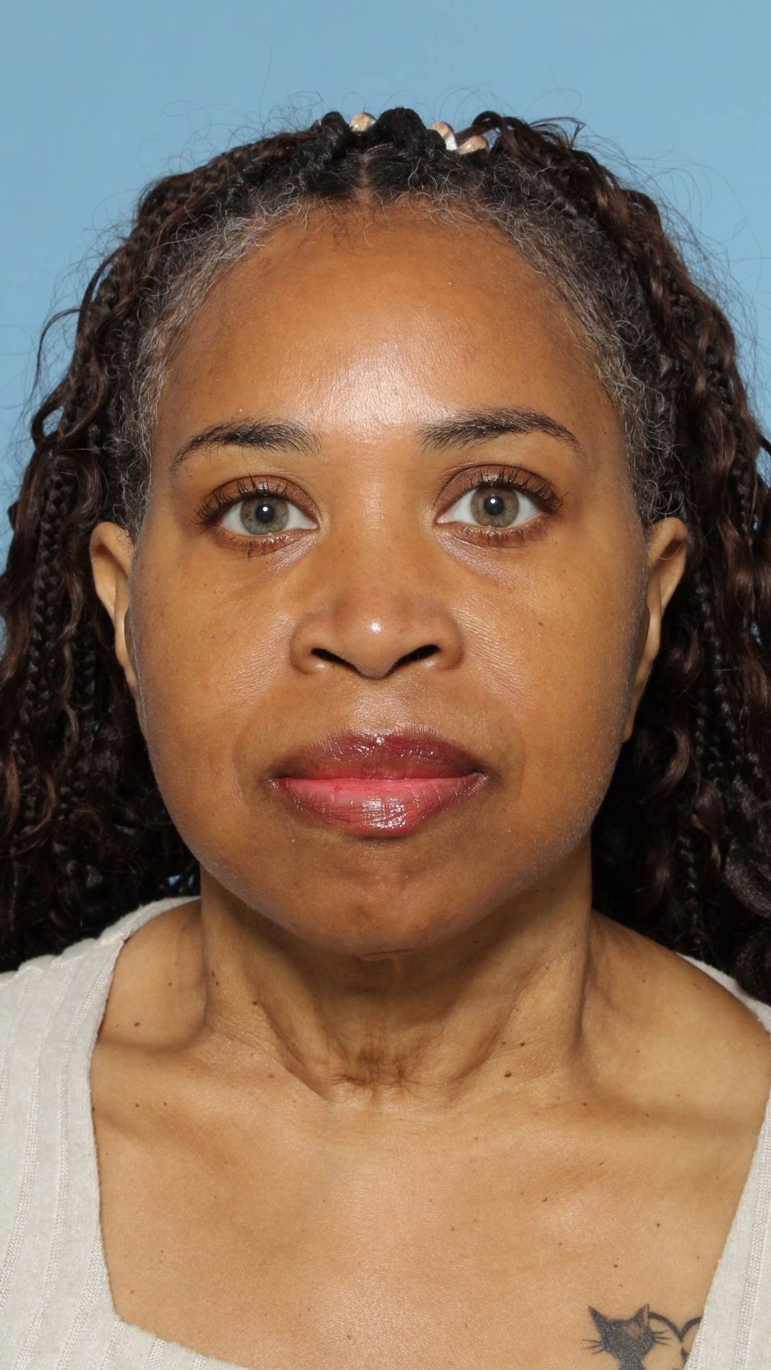 Before & After Image