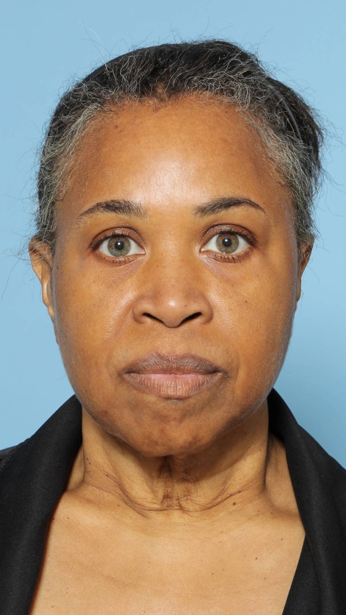 Before & After Image