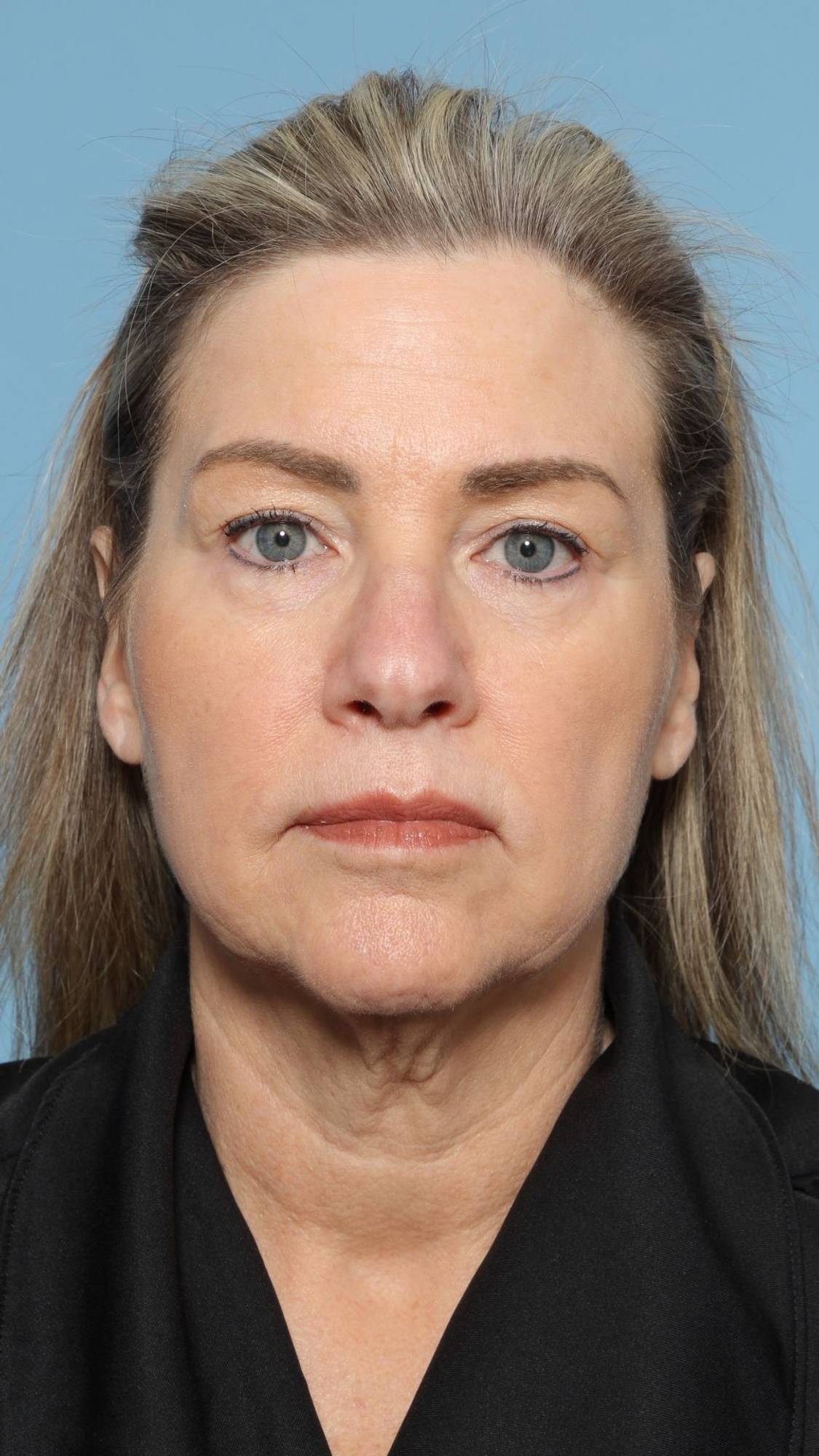 Before & After Image