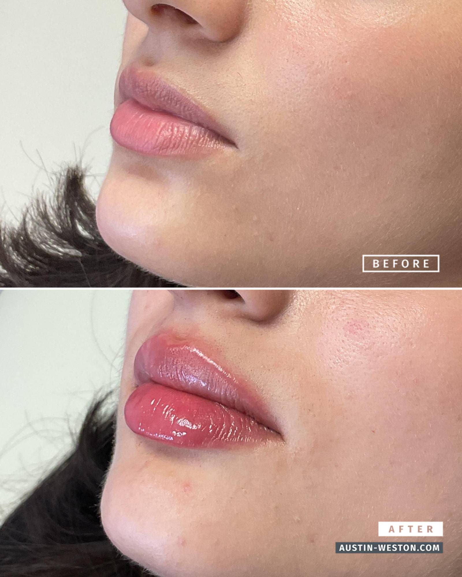 Before & After Image