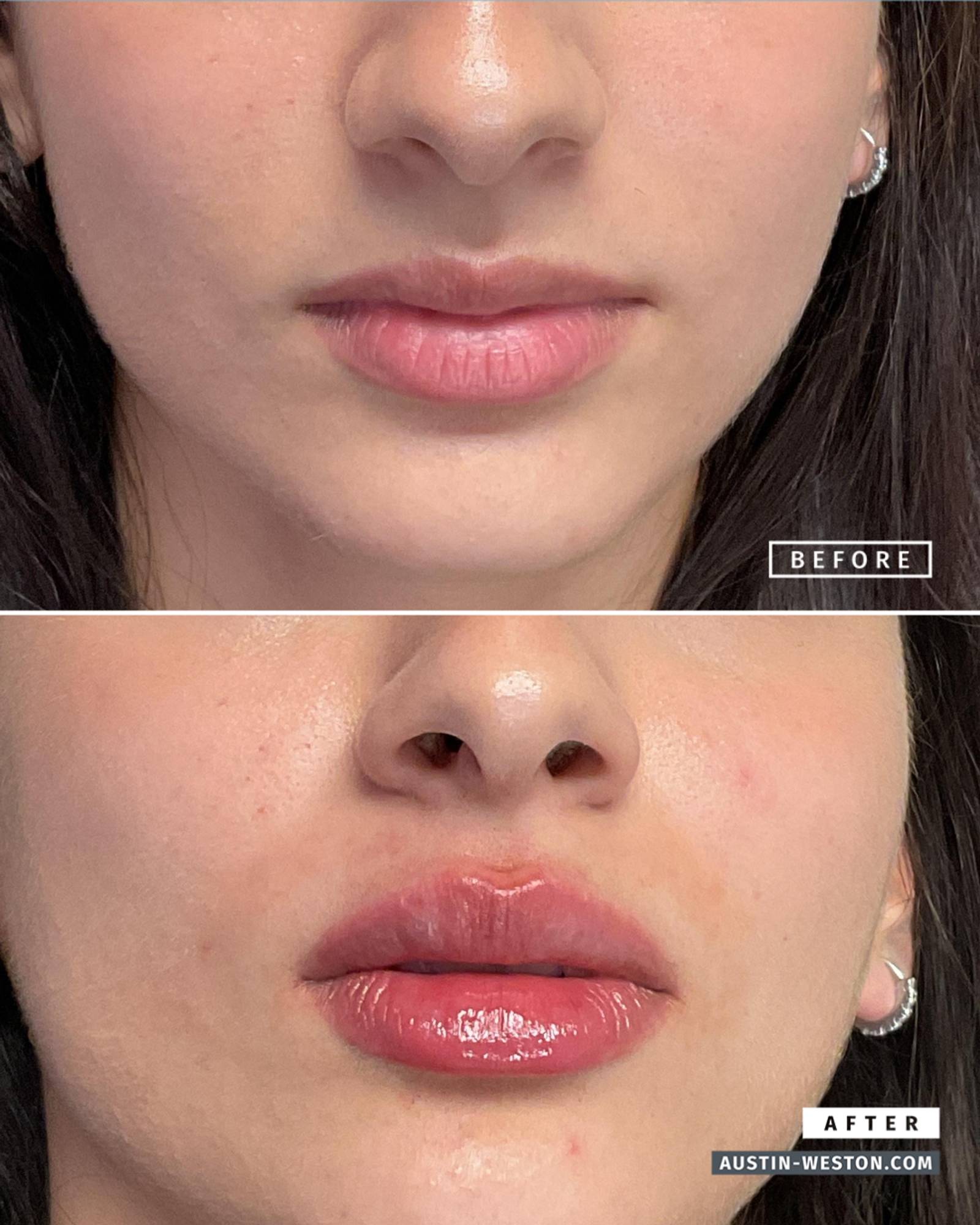 Before & After Image