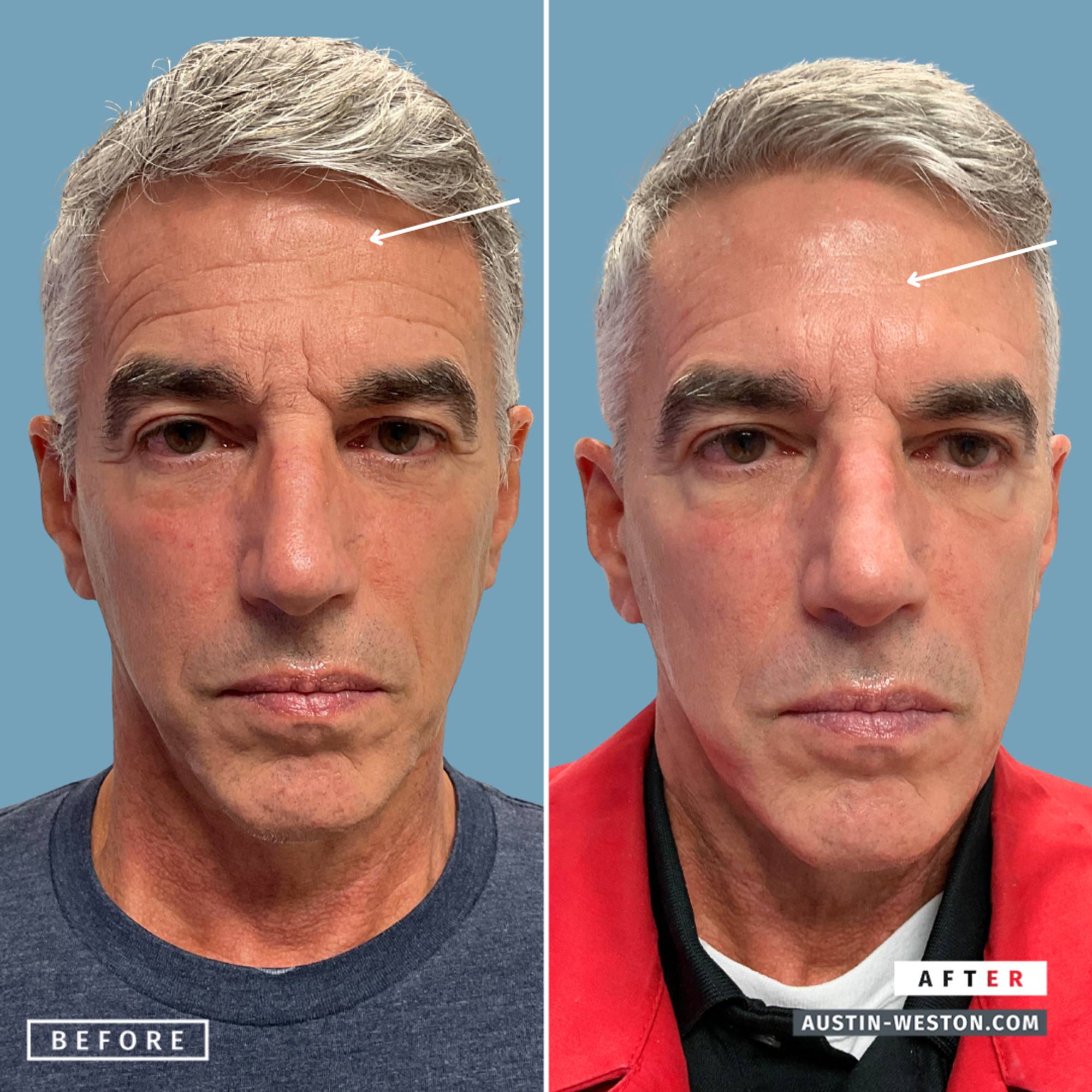 Before & After Image