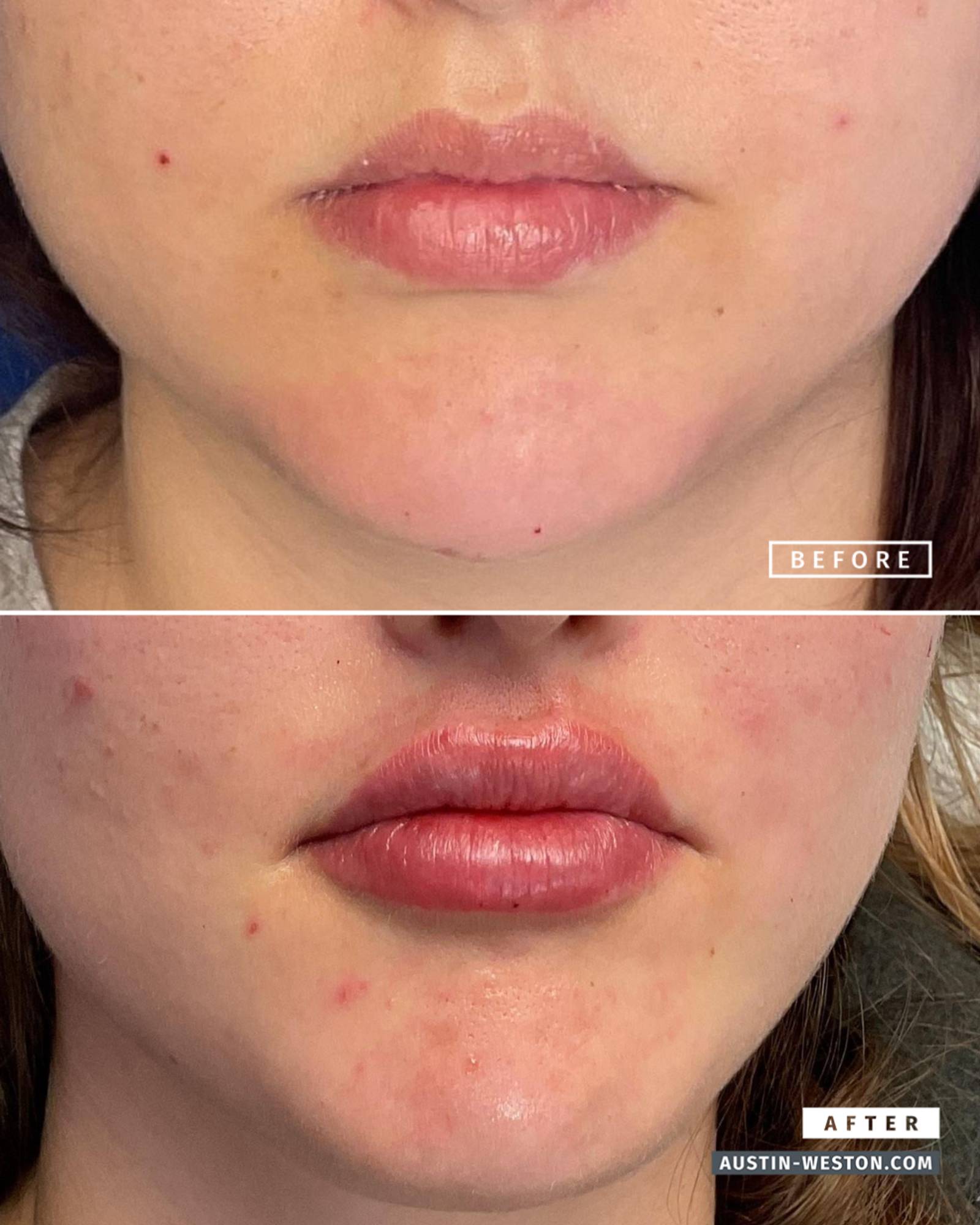 Before & After Image