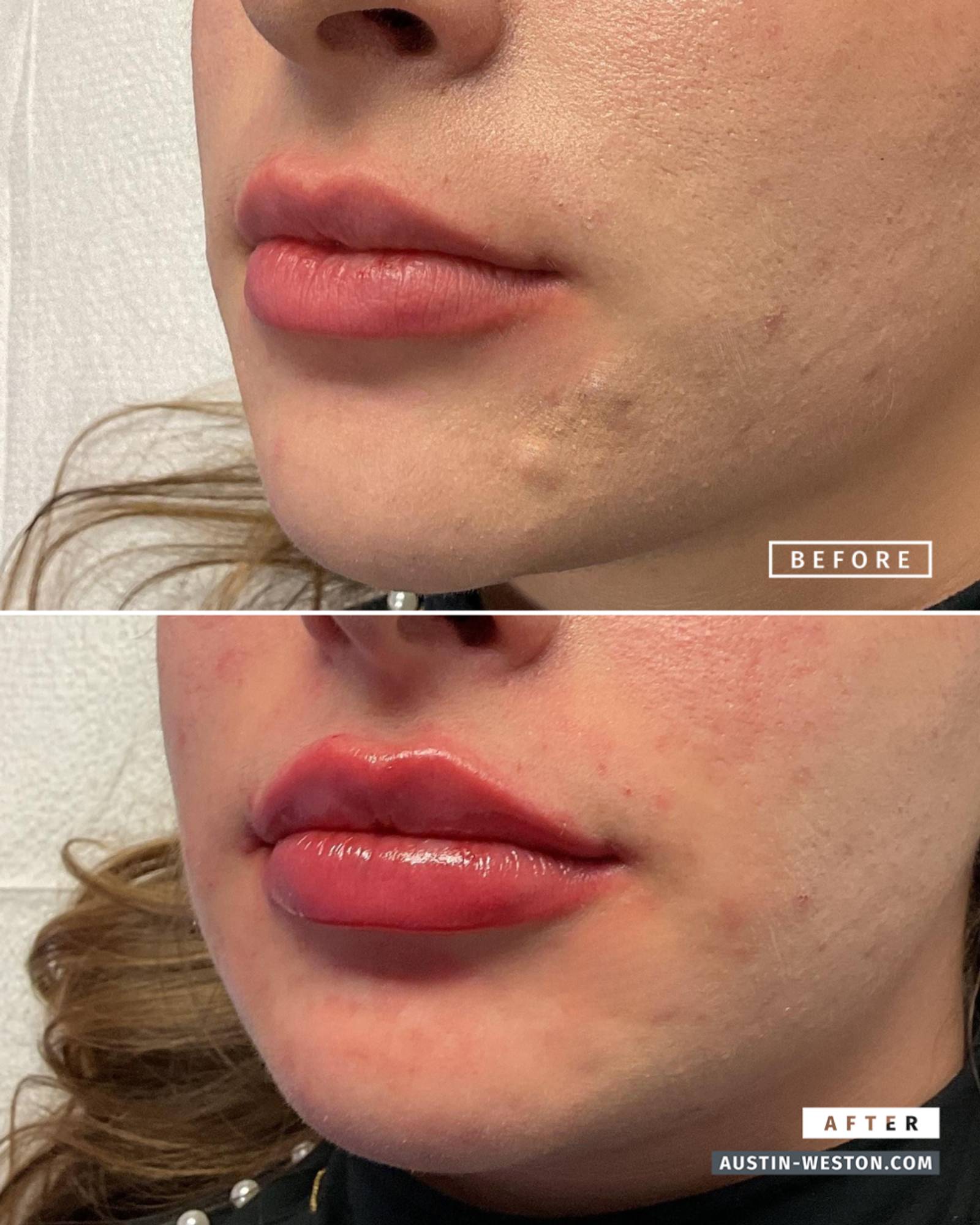 Before & After Image