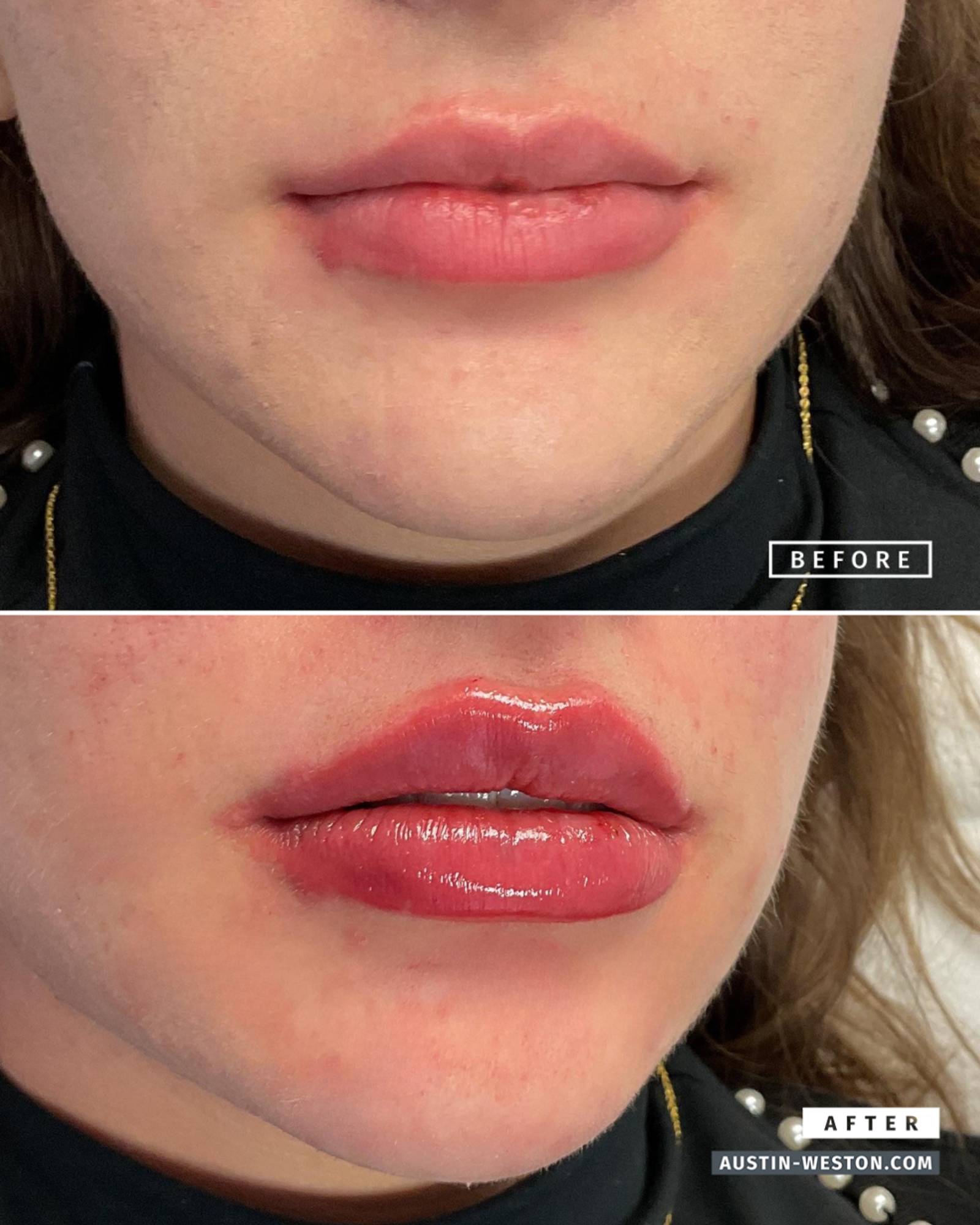 Before & After Image