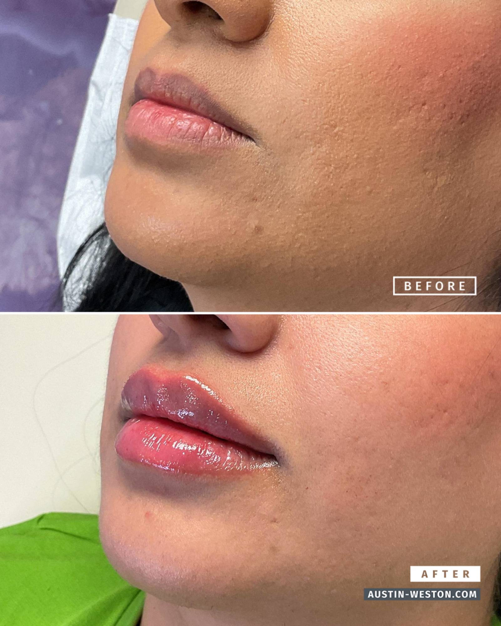 Before & After Image