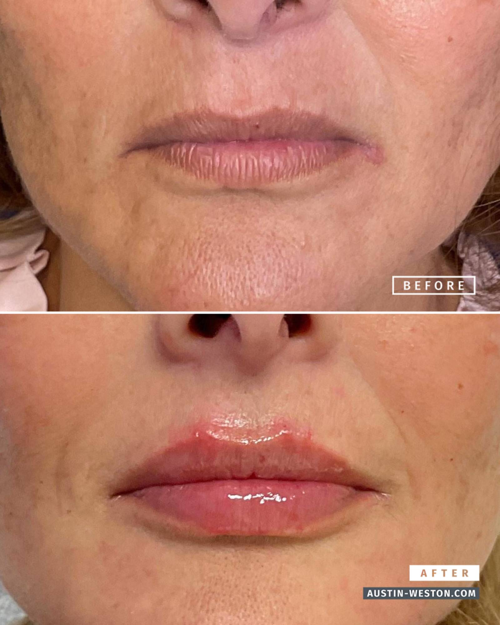 Before & After Image