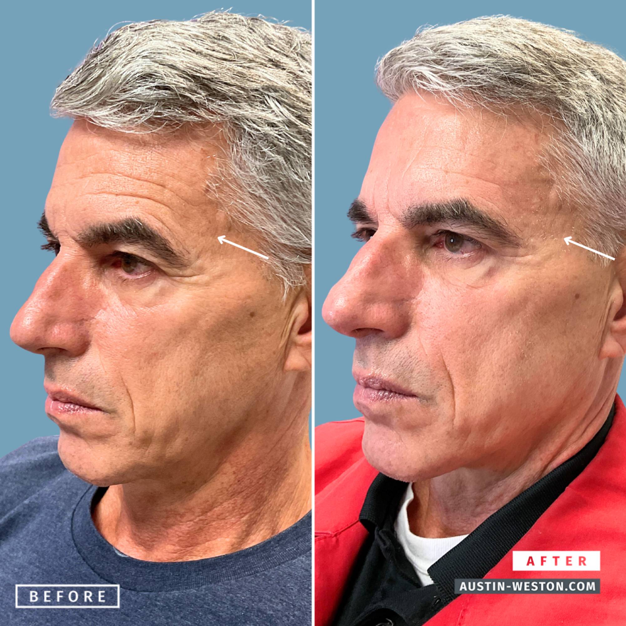 Before & After Image