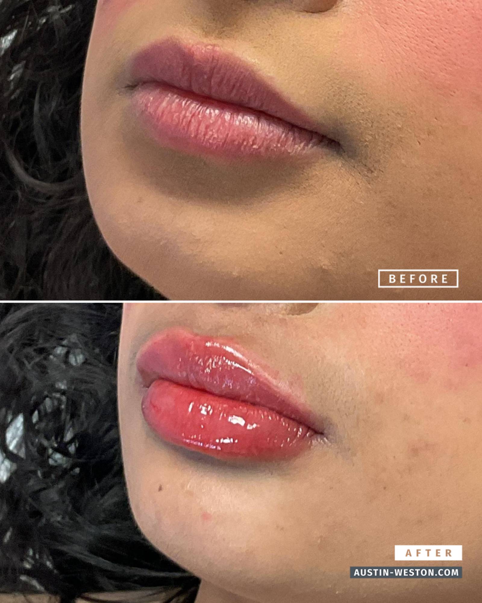 Before & After Image