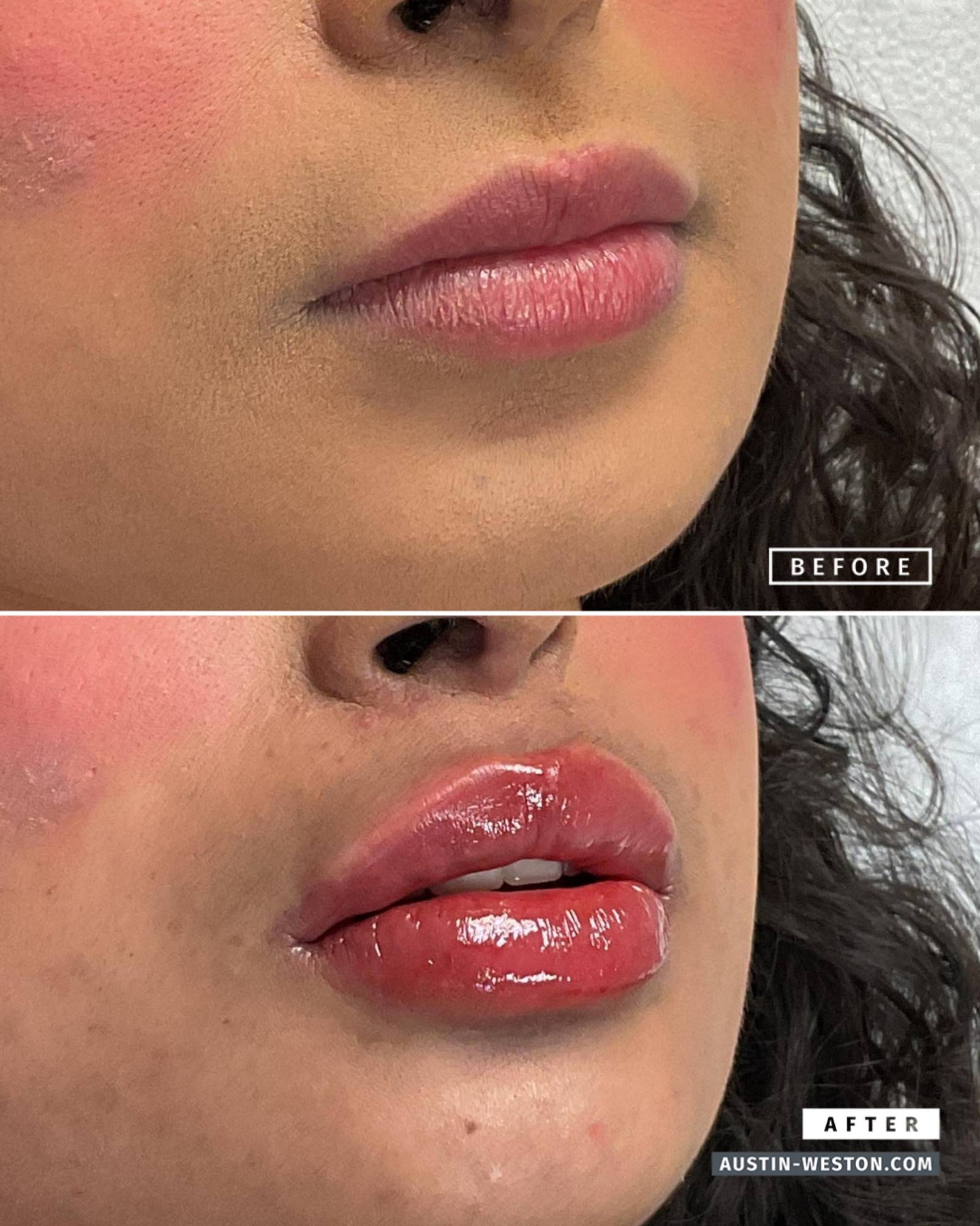 Before & After Image