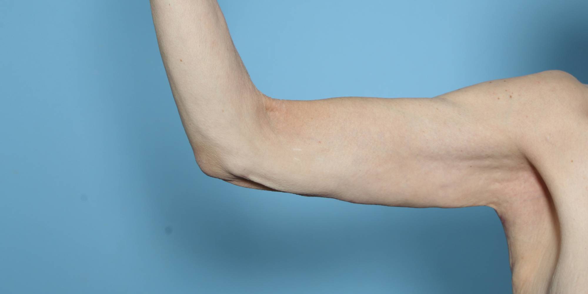 Before & After Image