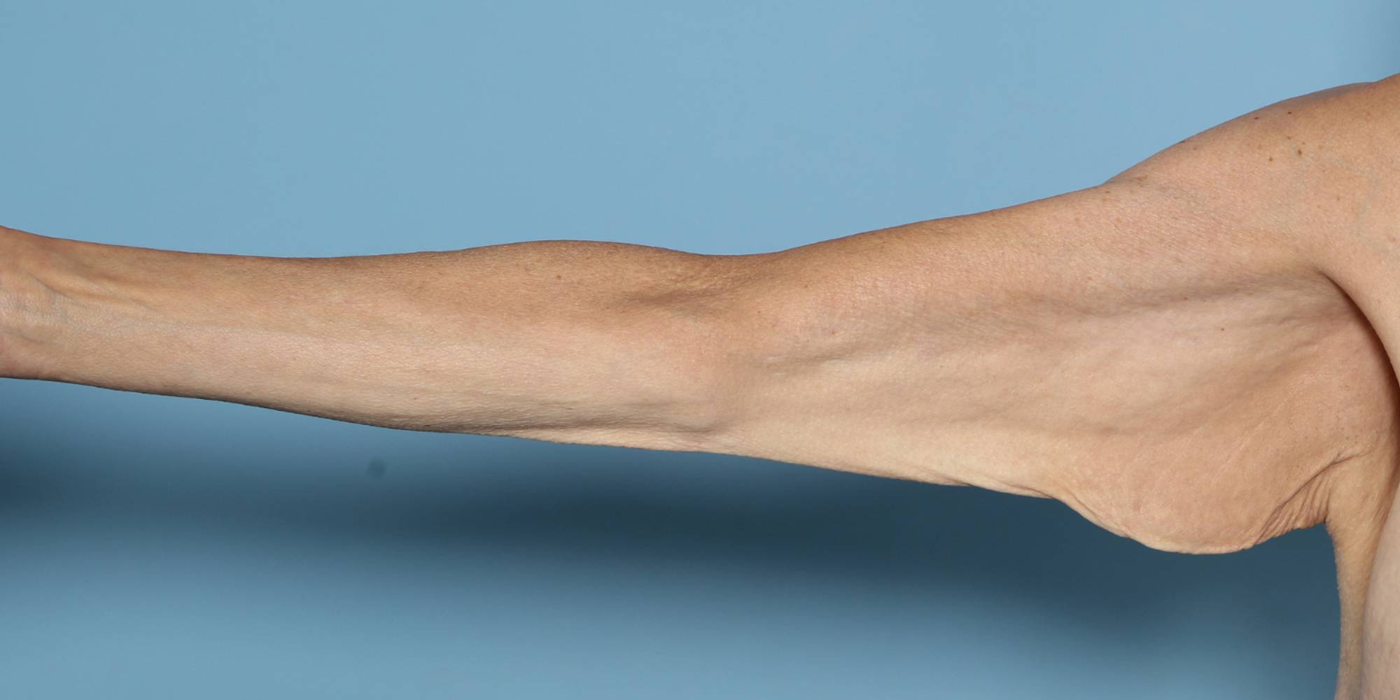 Before & After Image