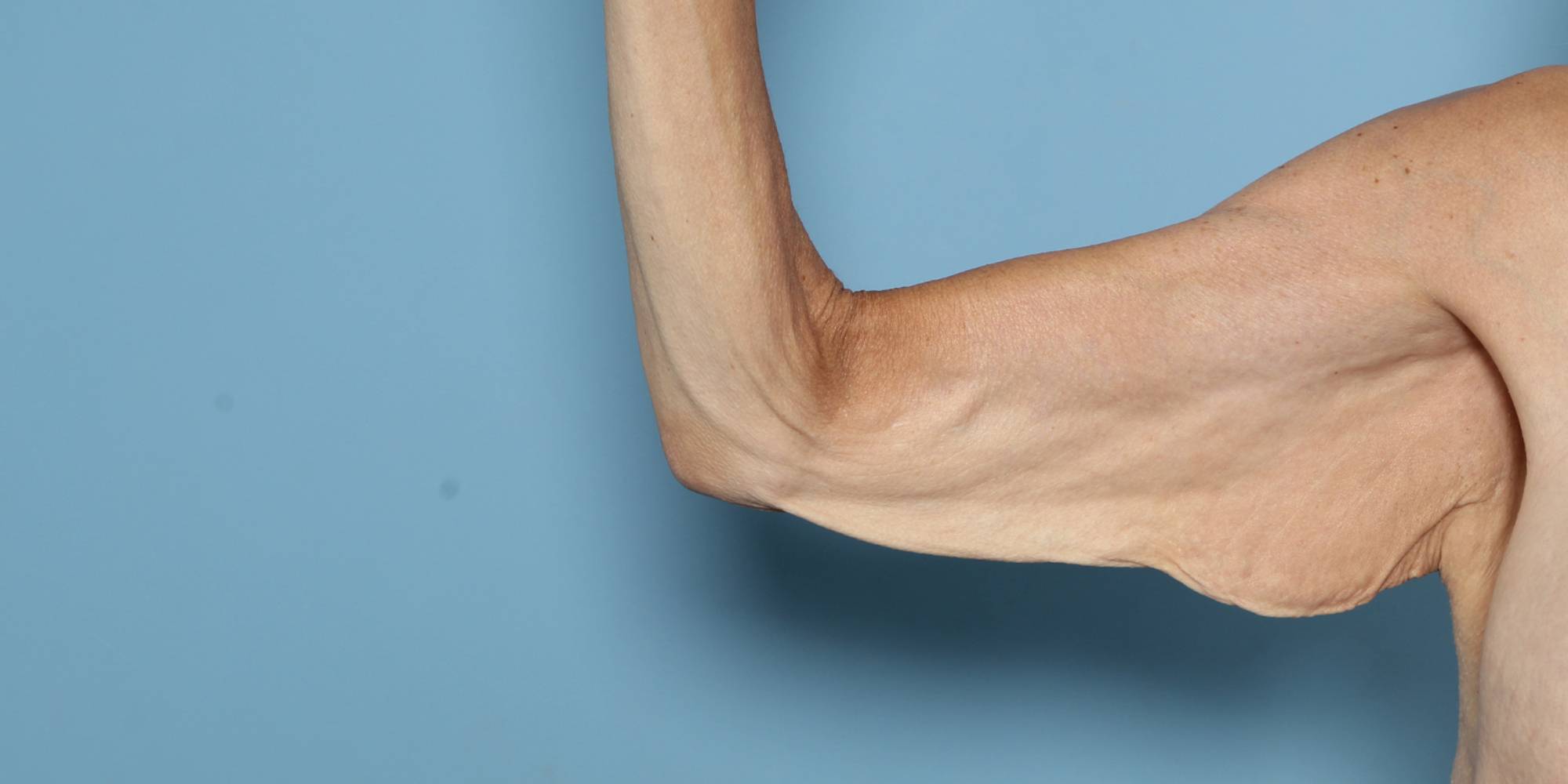 Before & After Image